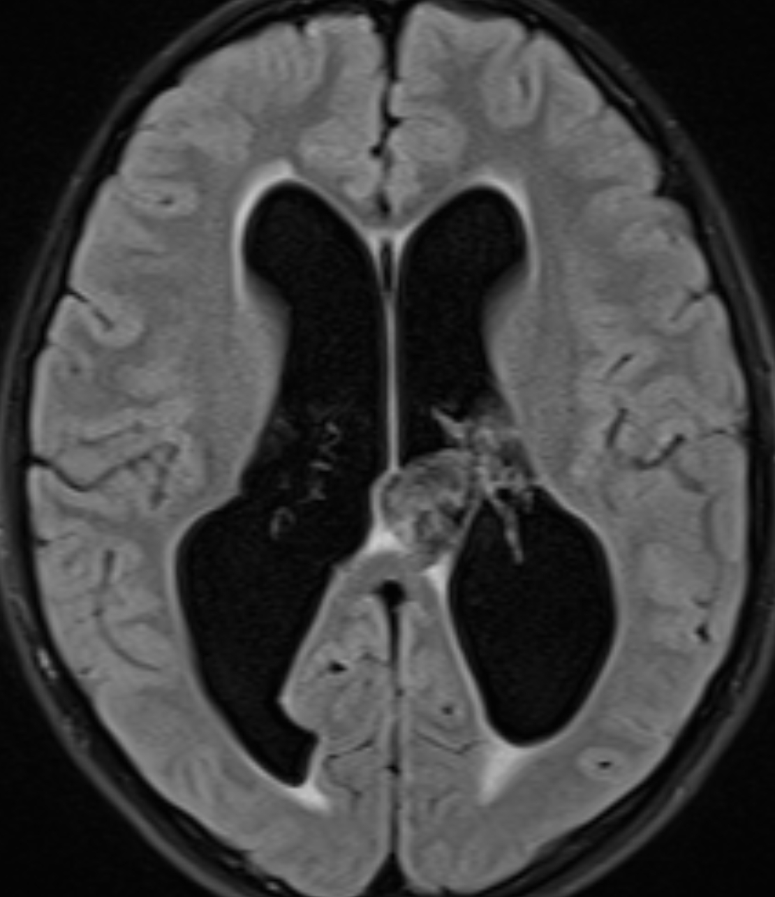 Left Image