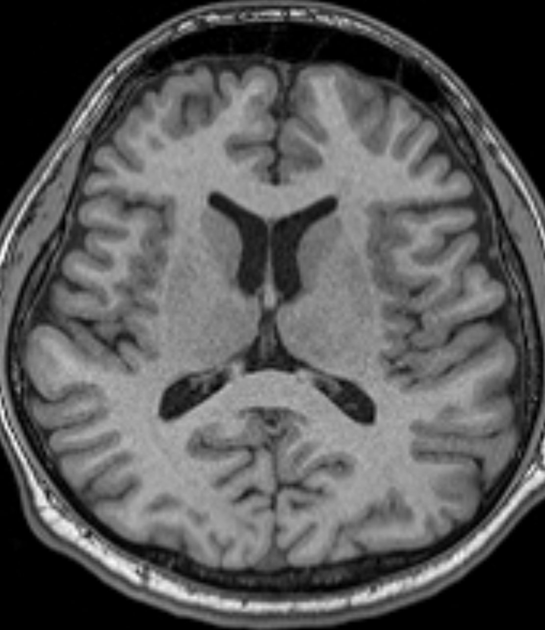 Left Image