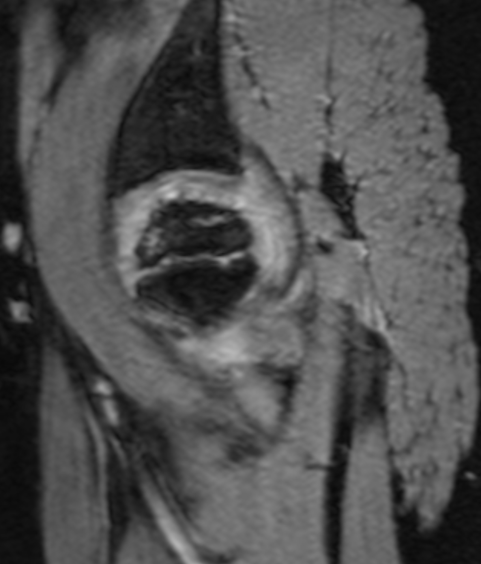 Left Image