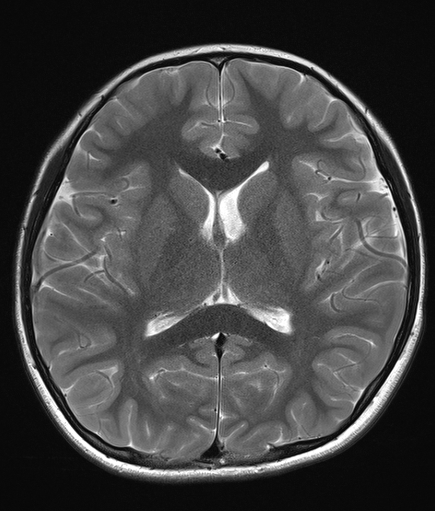 Left Image