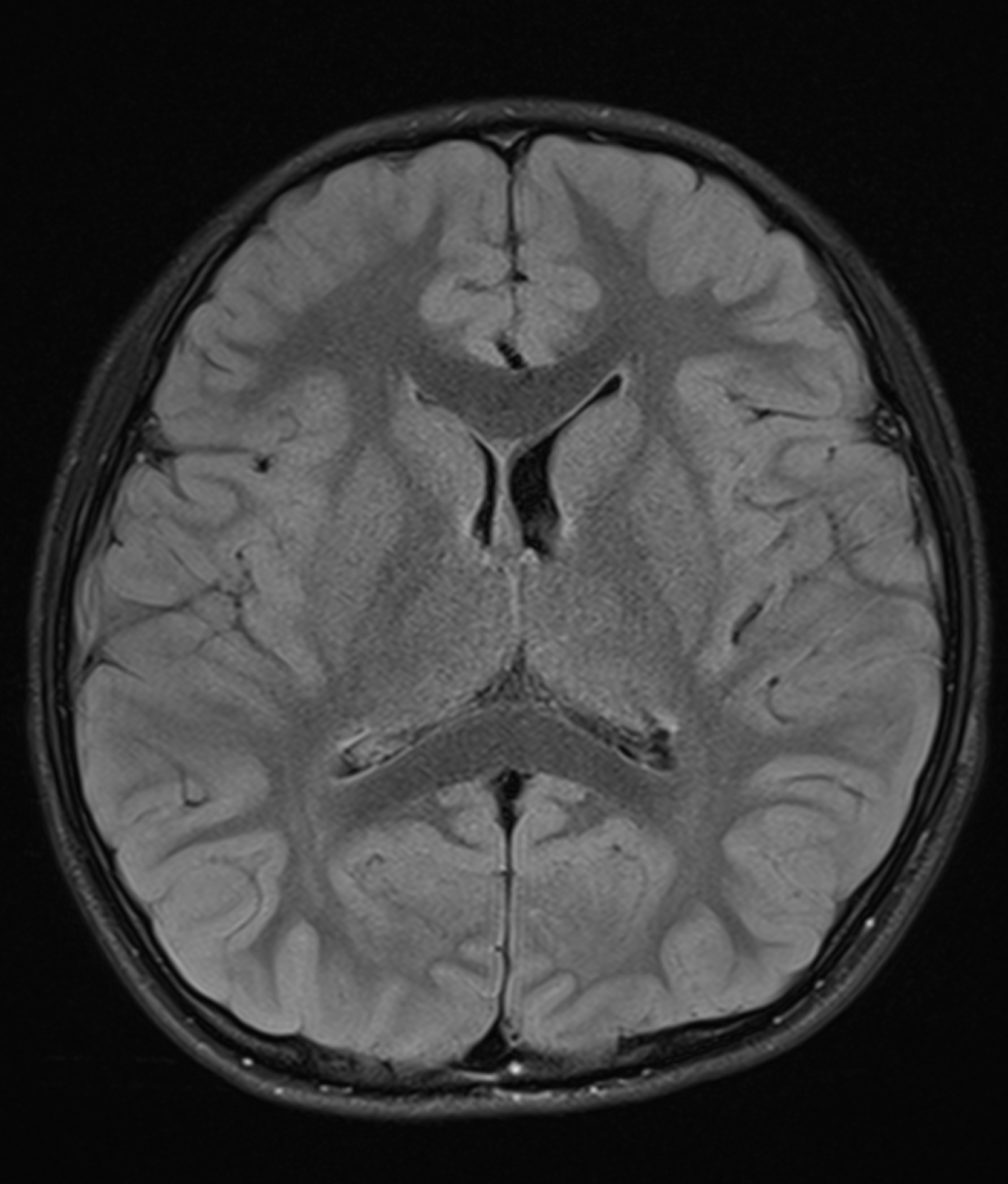 Left Image