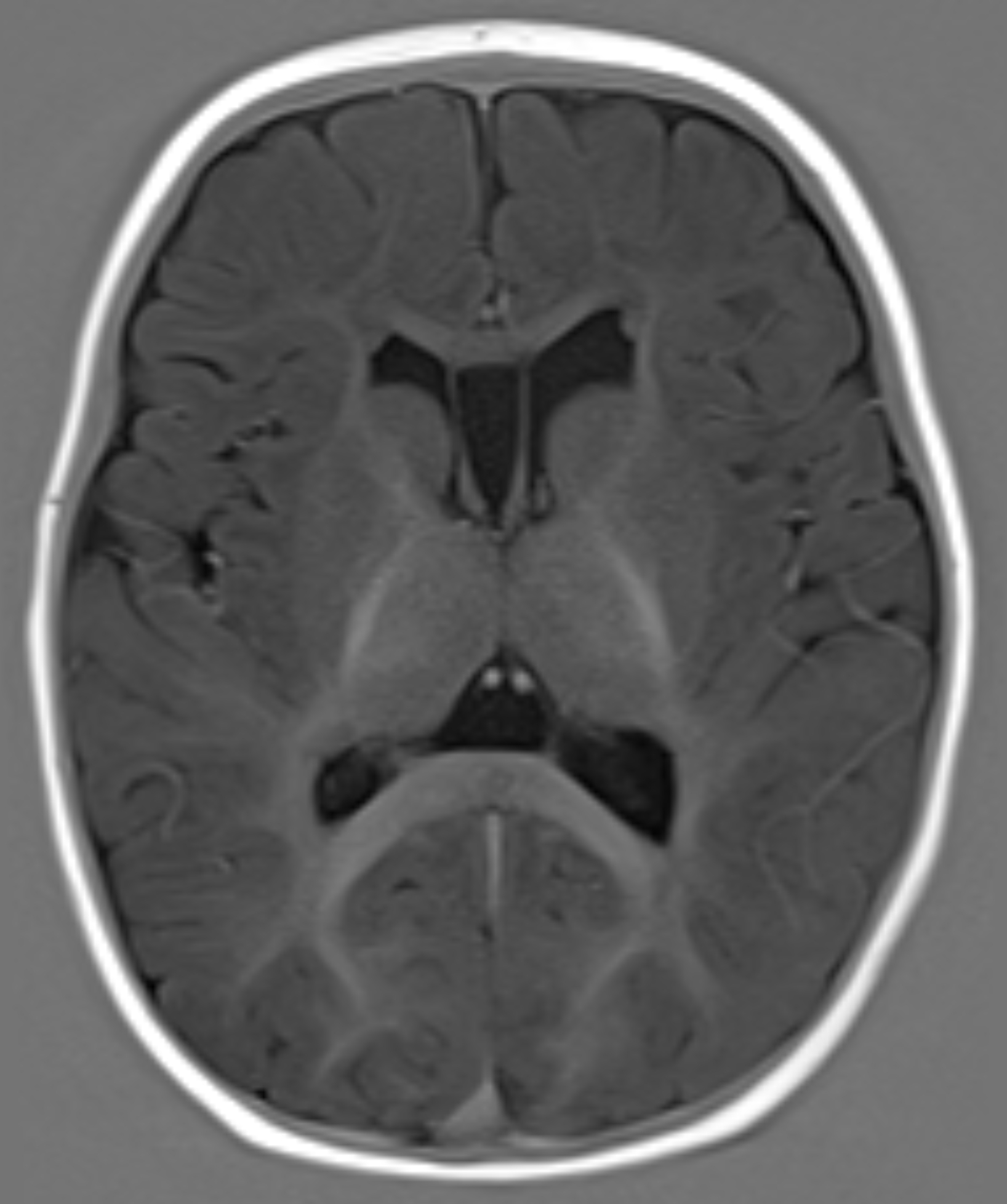 Left Image