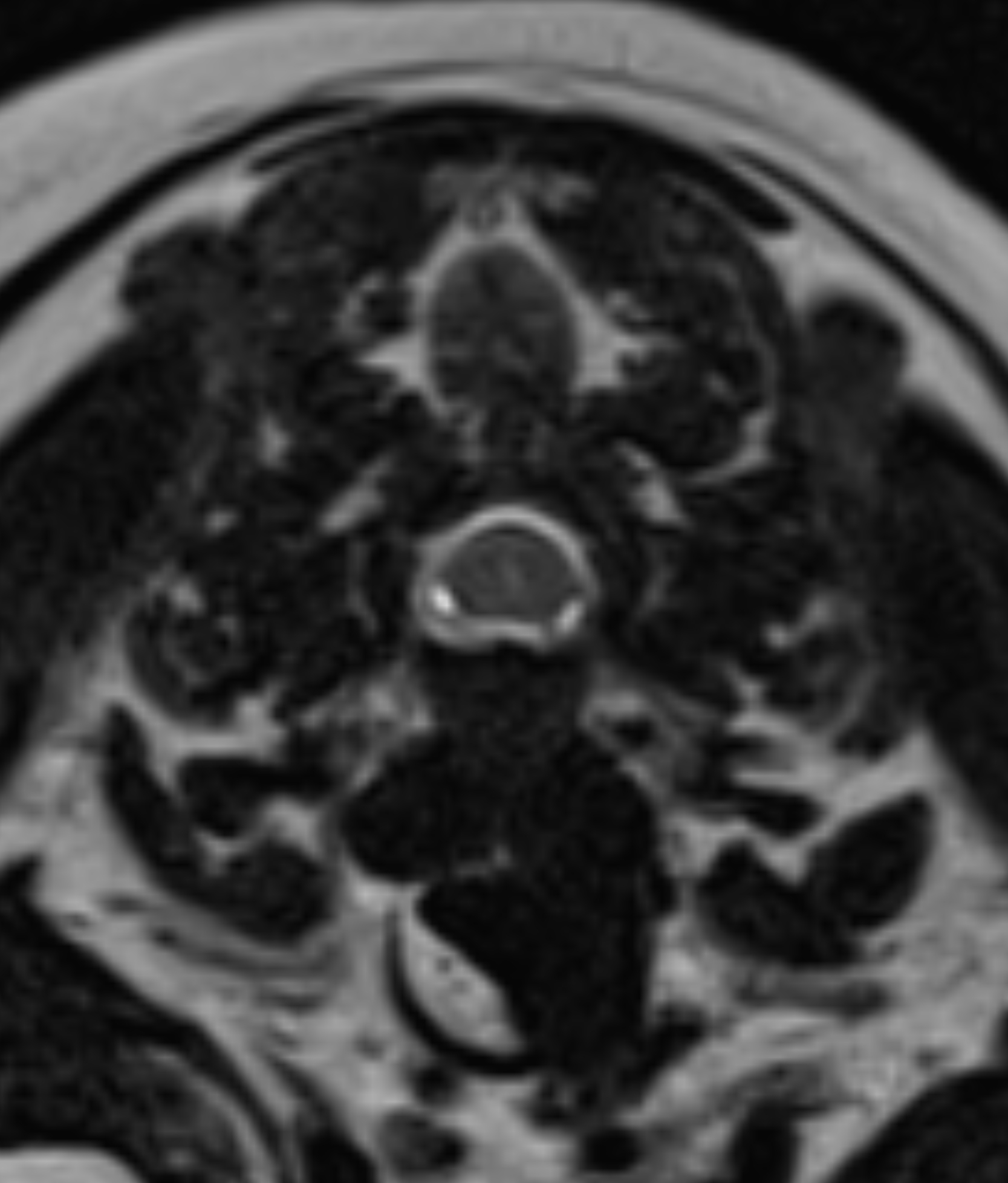 Left Image