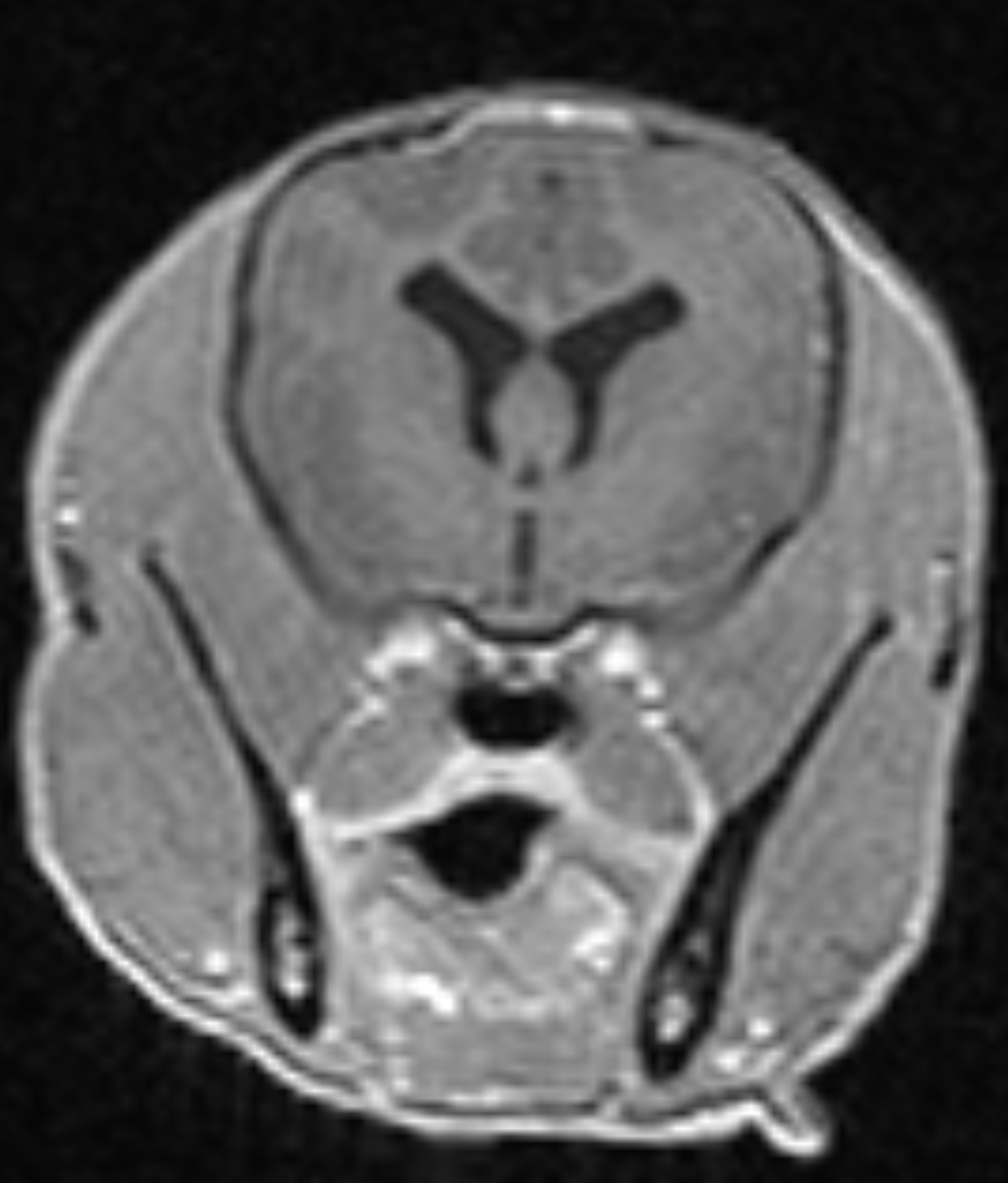 Left Image