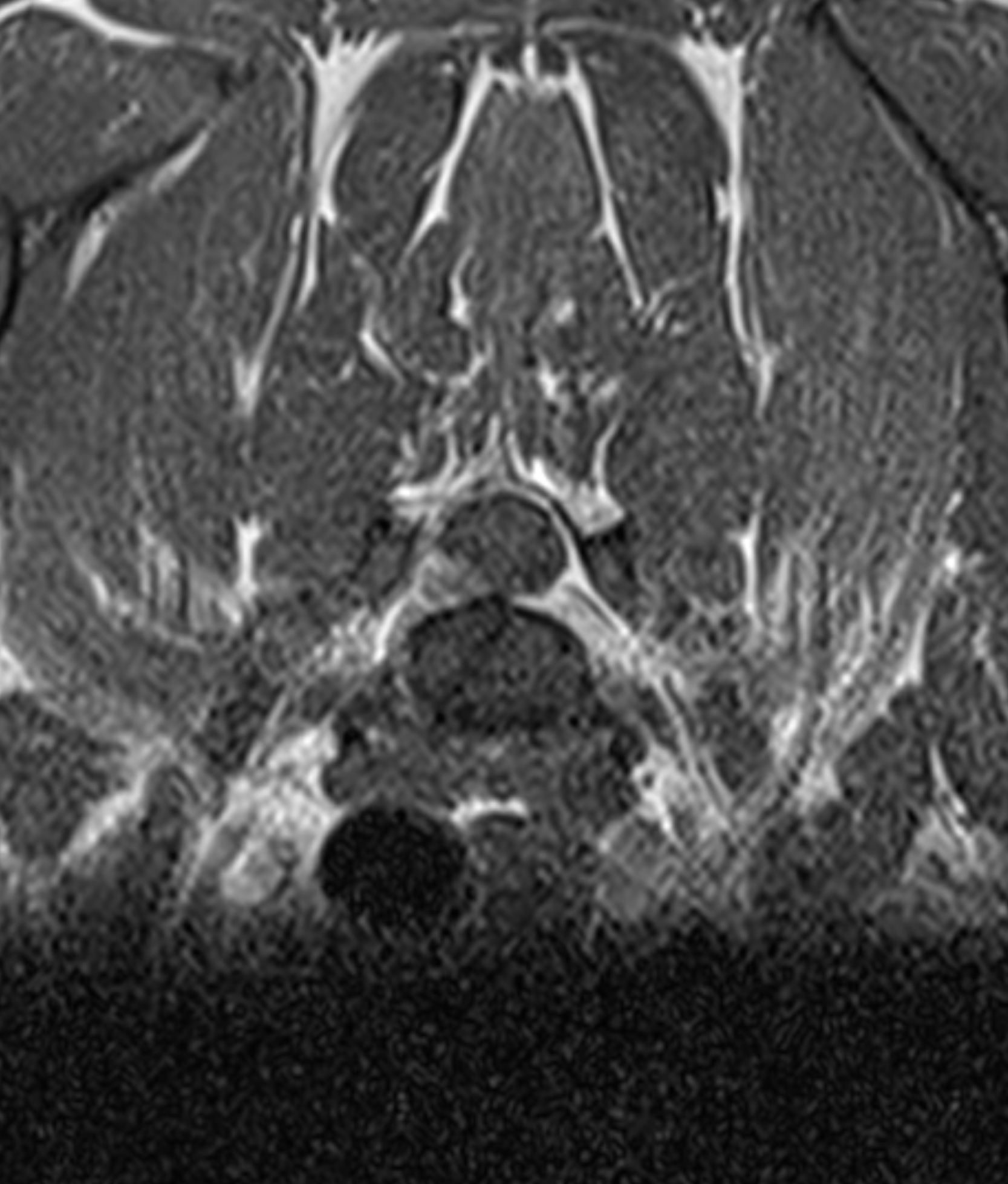 Left Image
