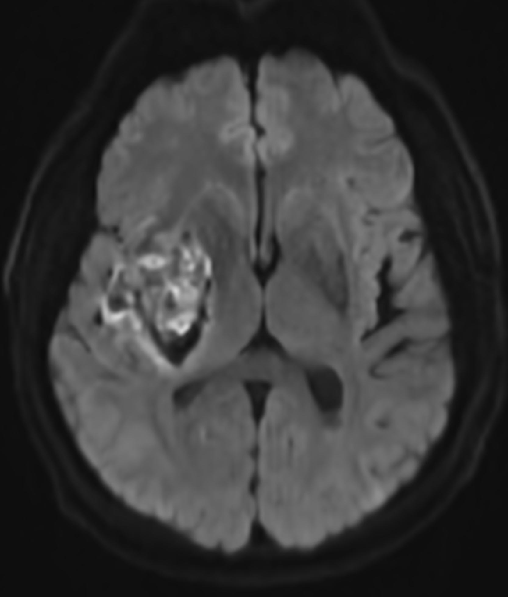 Right Image