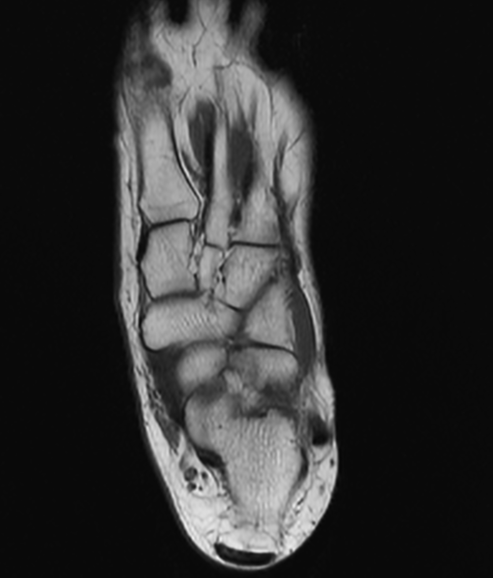 Right Image
