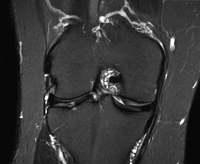 Right Image