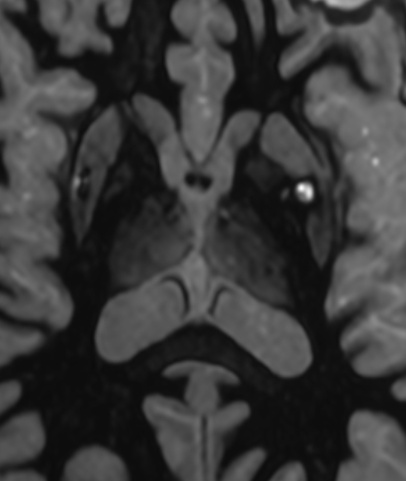 Right Image