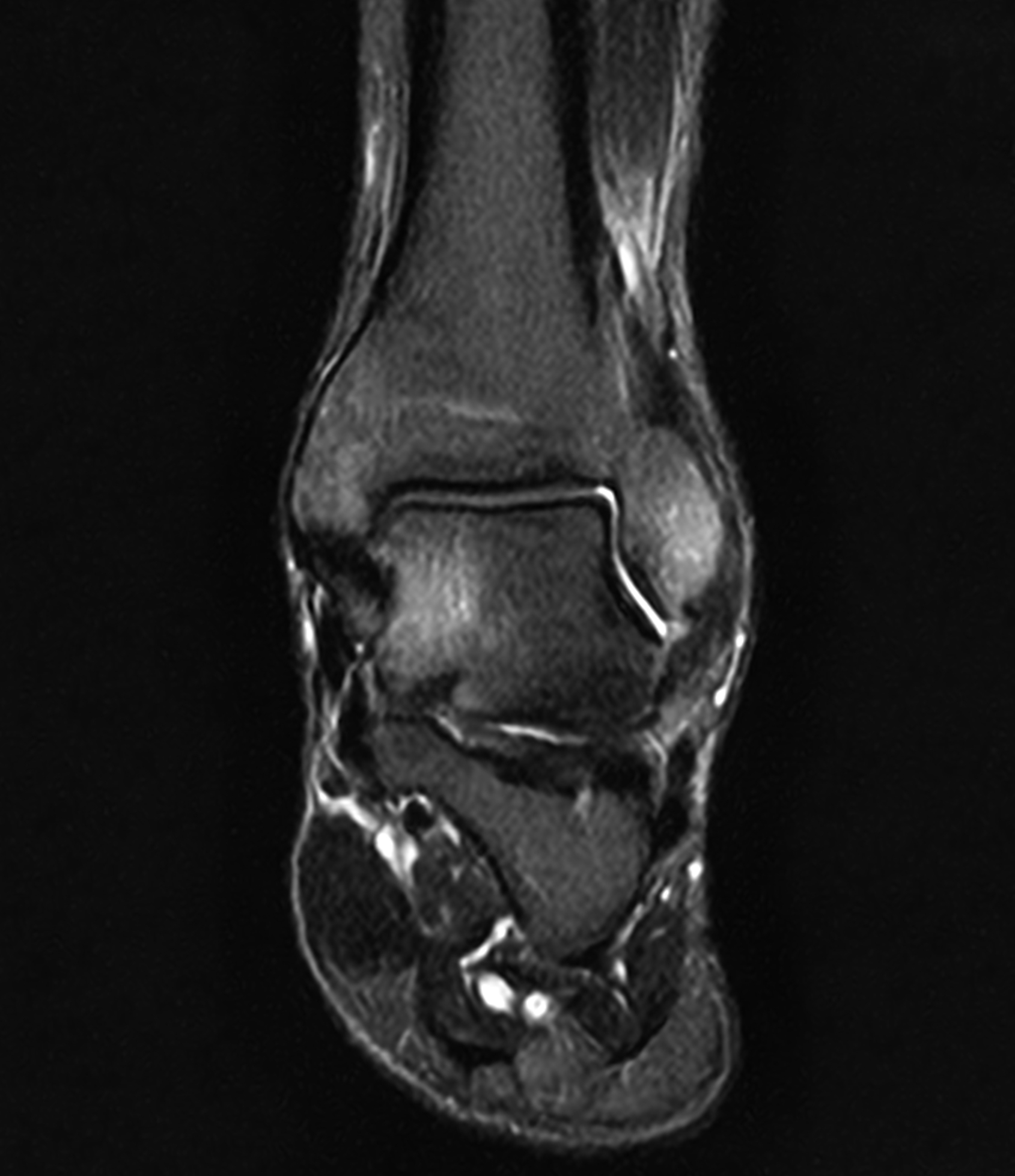 Right Image