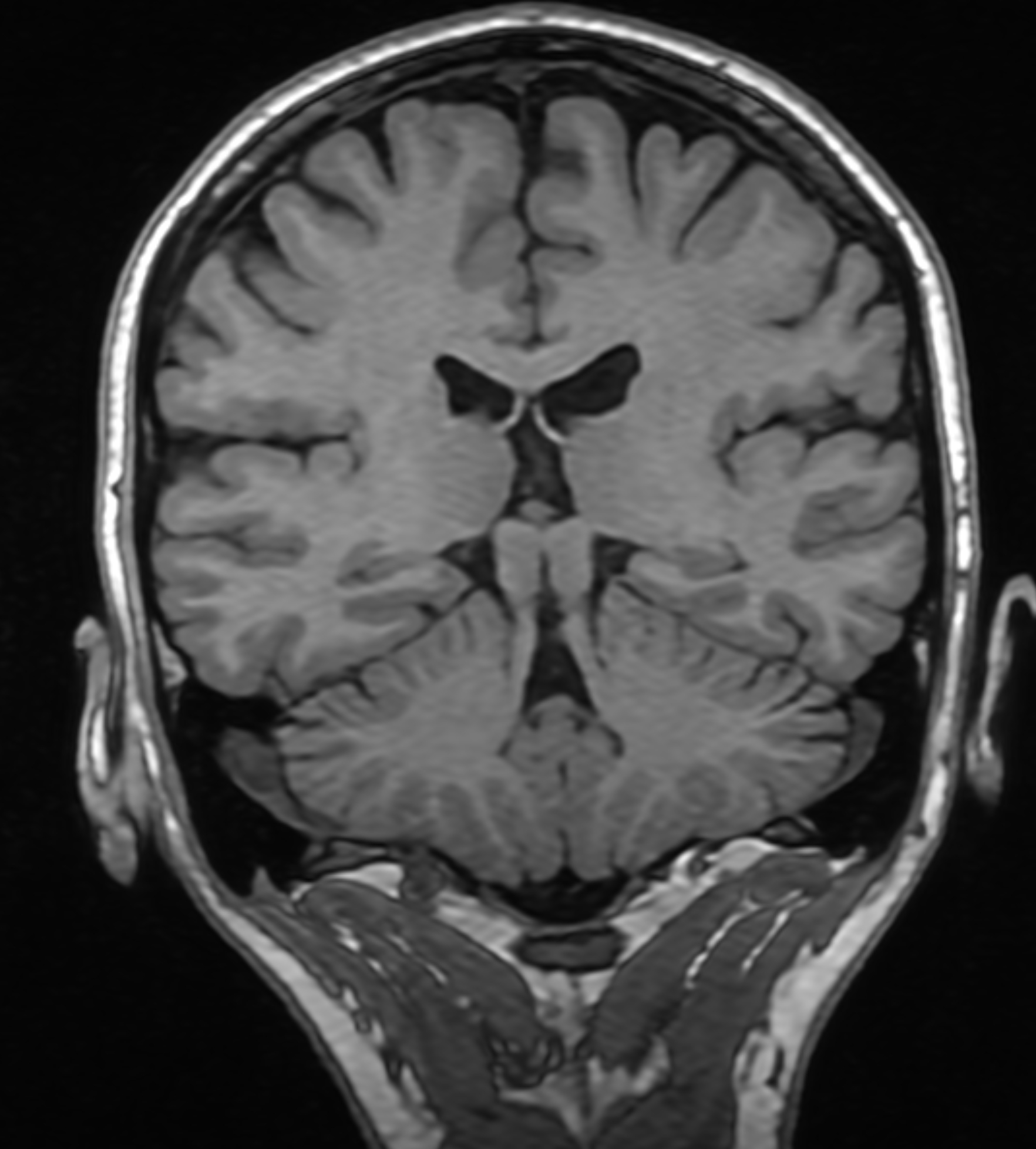 Right Image