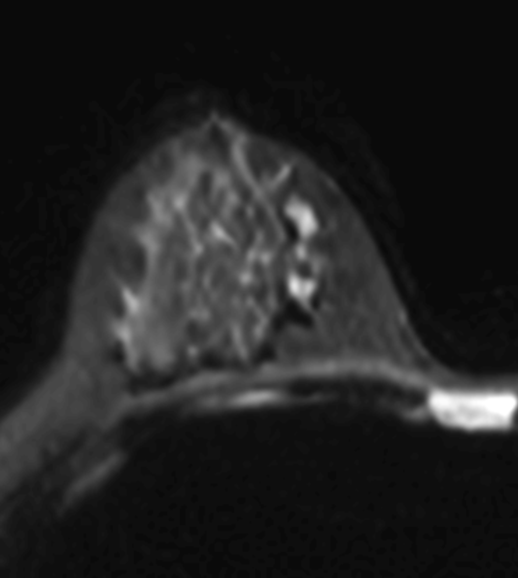 Right Image