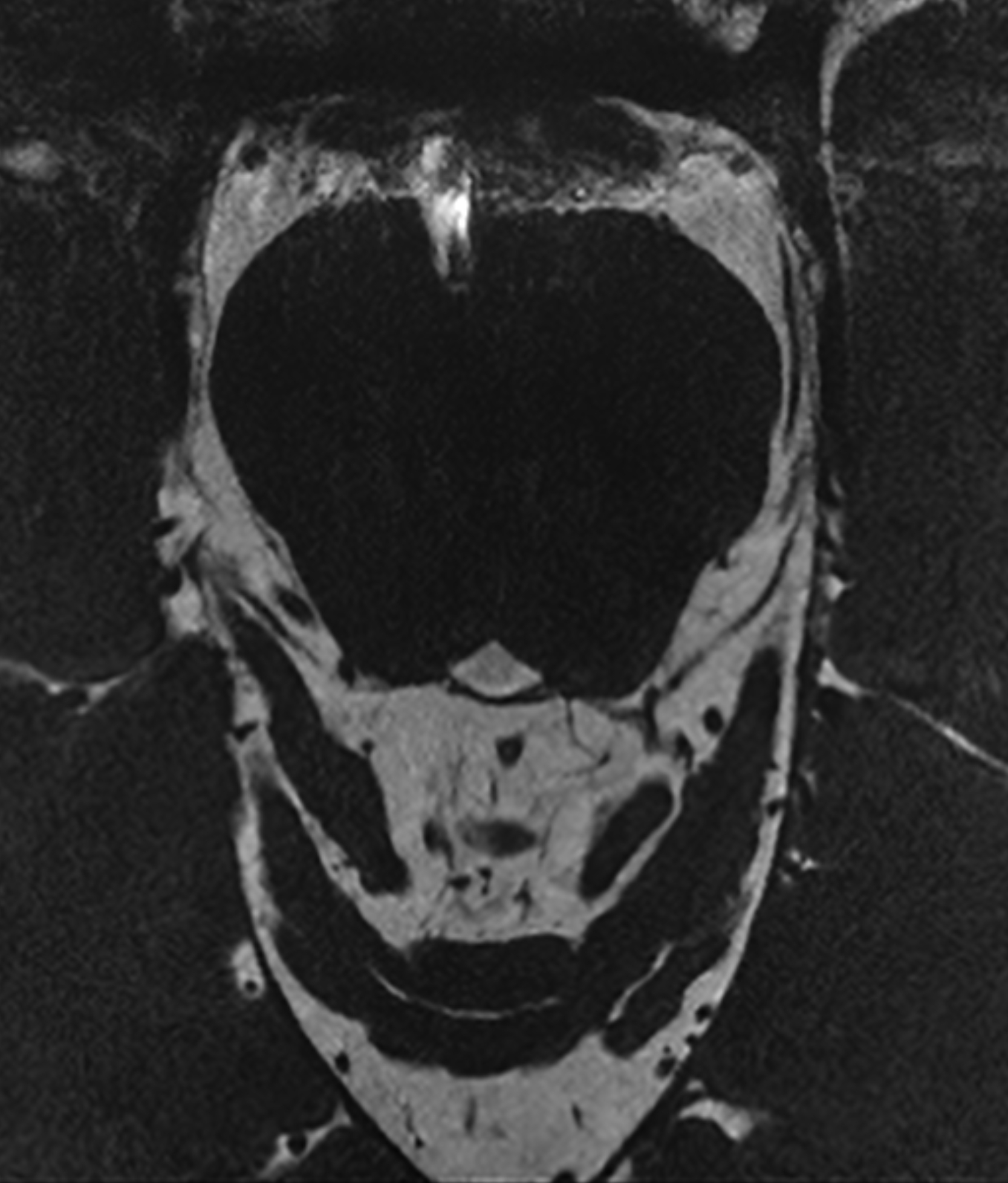 Right Image