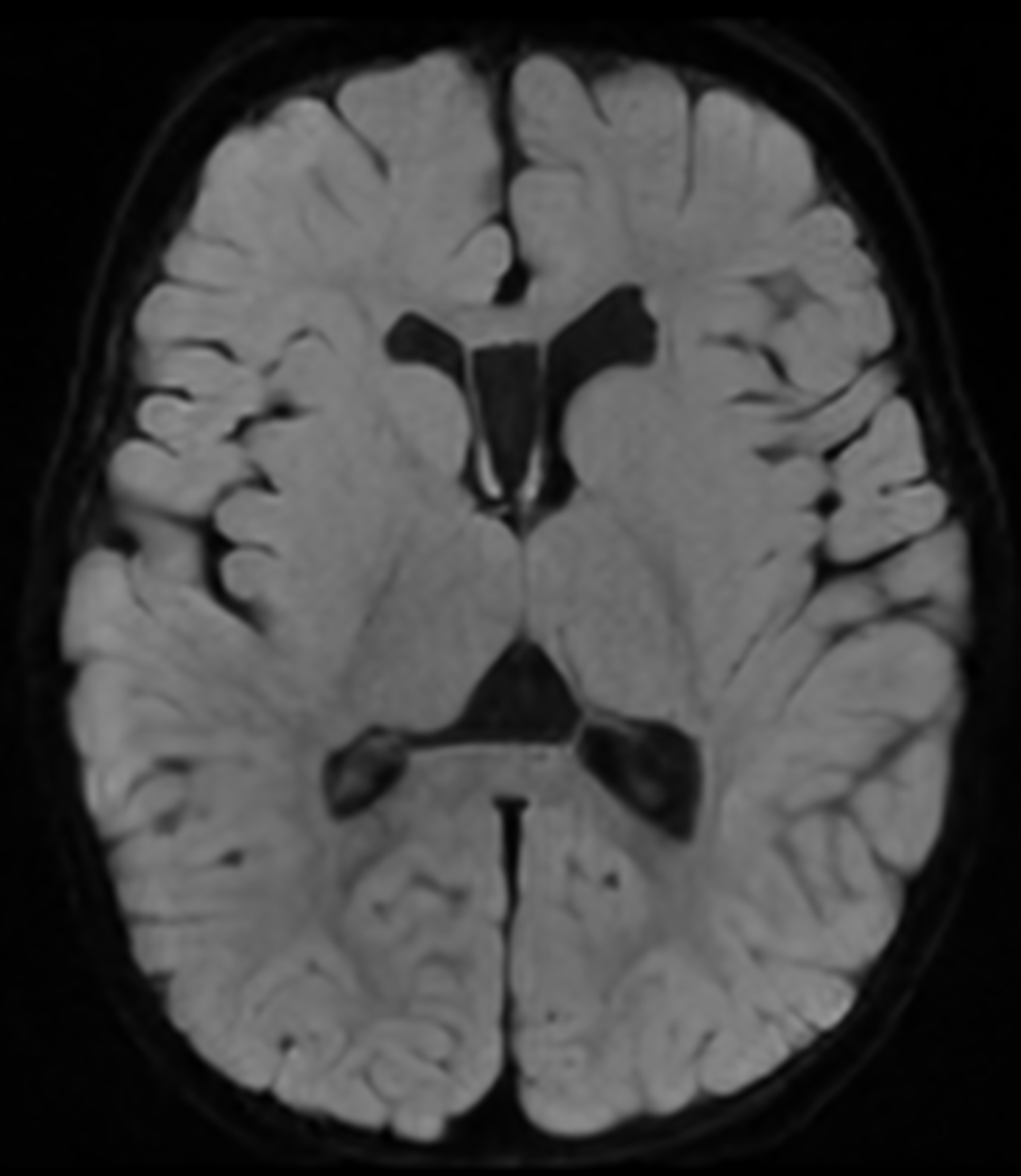 Right Image