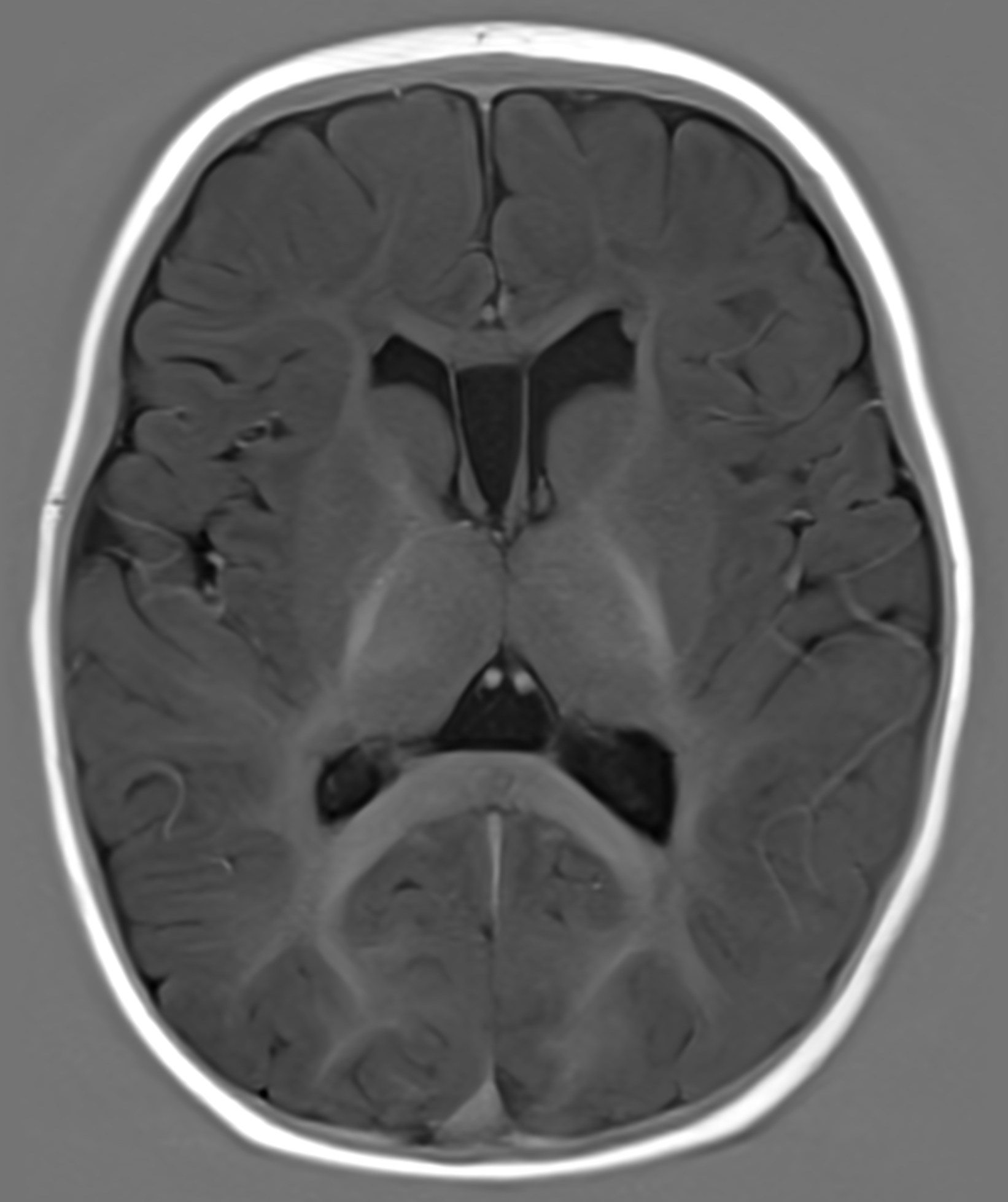 Right Image