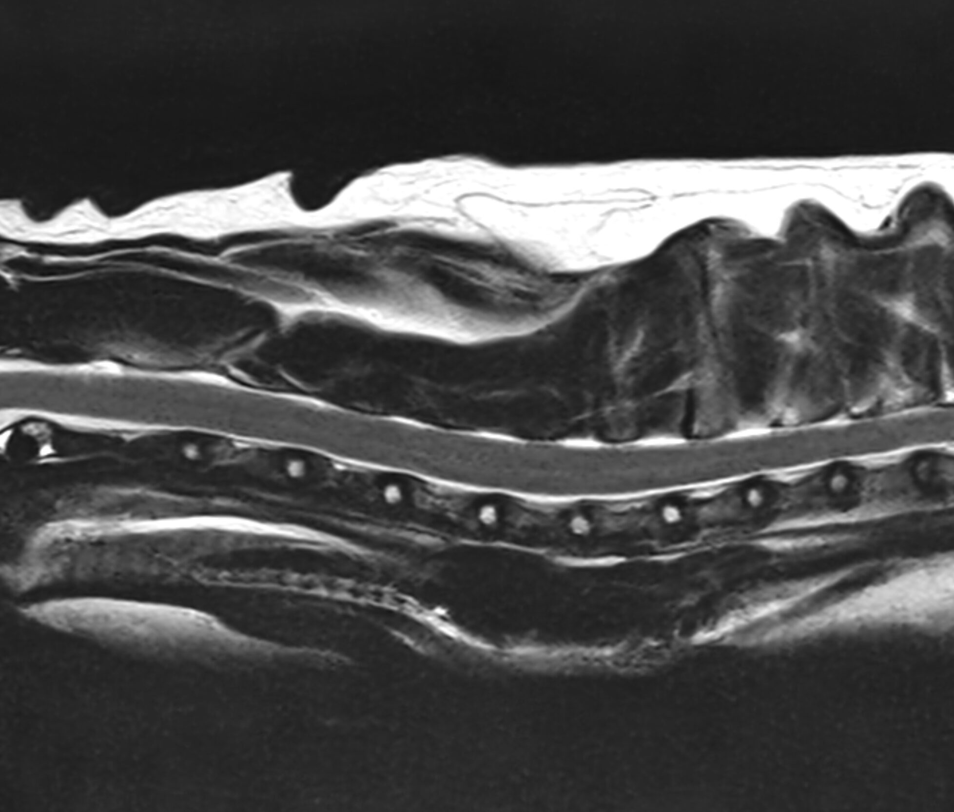 Right Image