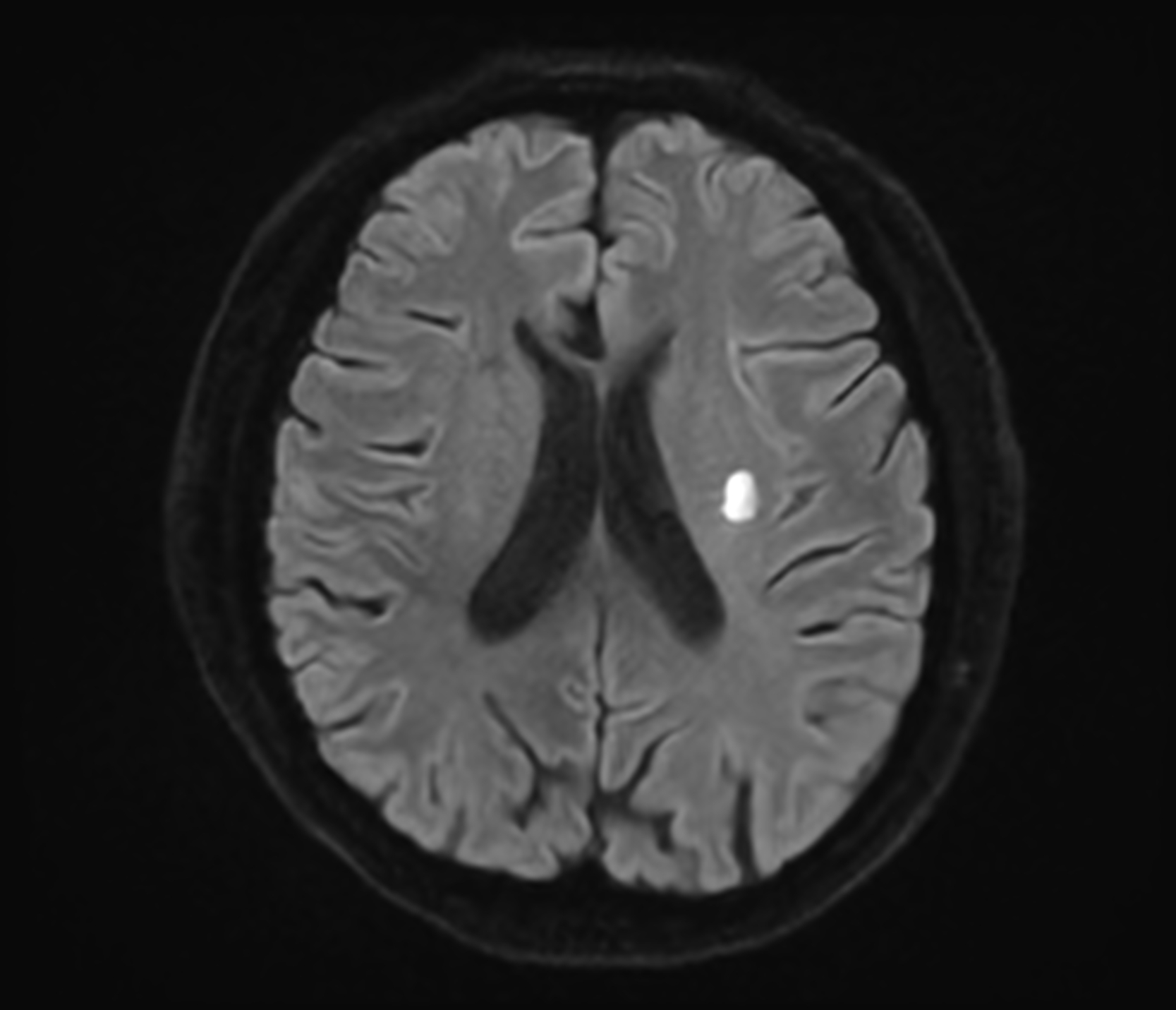Right Image