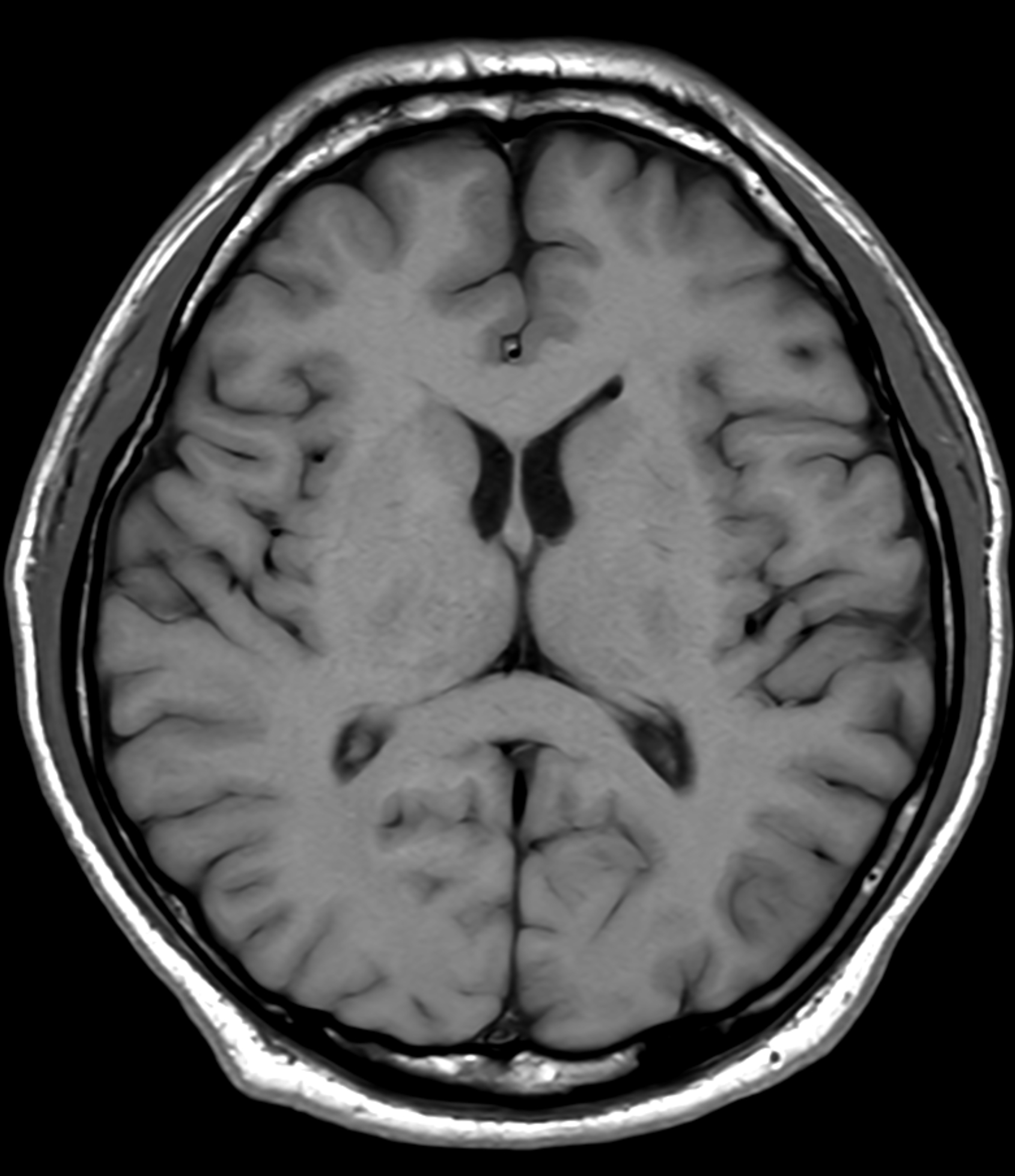 Right Image