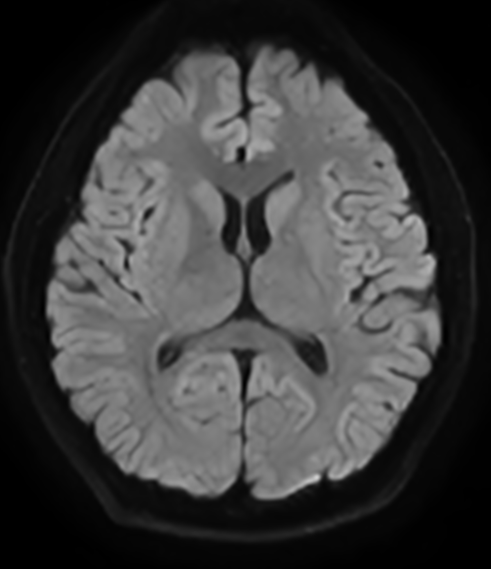 Right Image