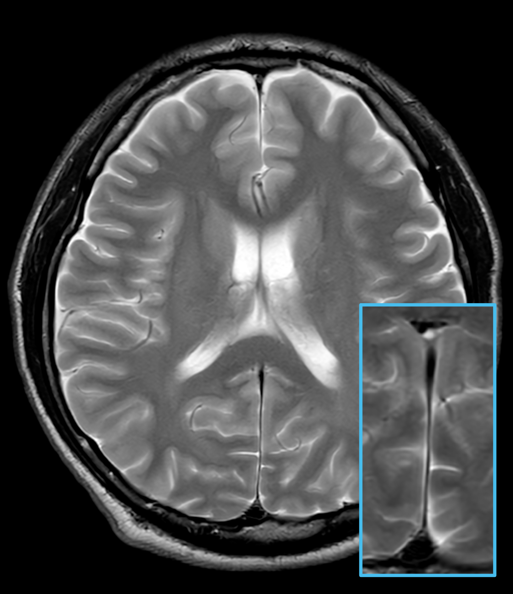 Right Image