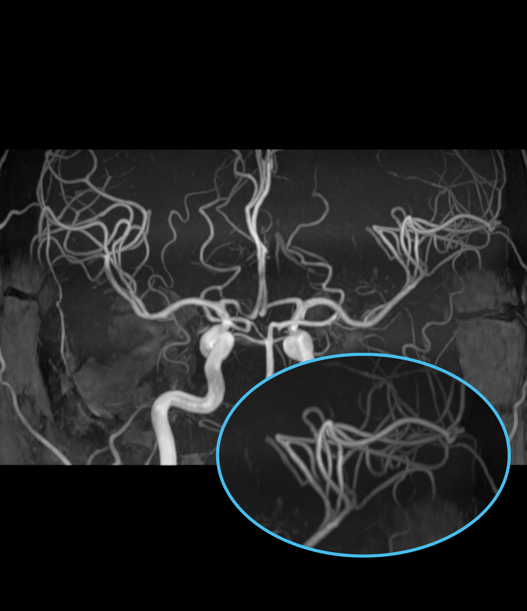 Right Image