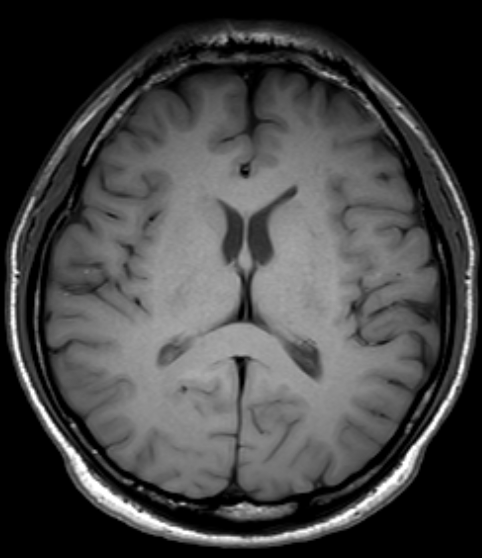 Left Image