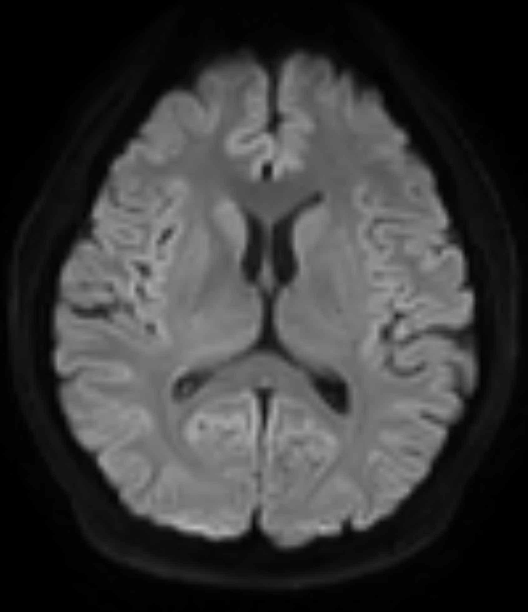Left Image