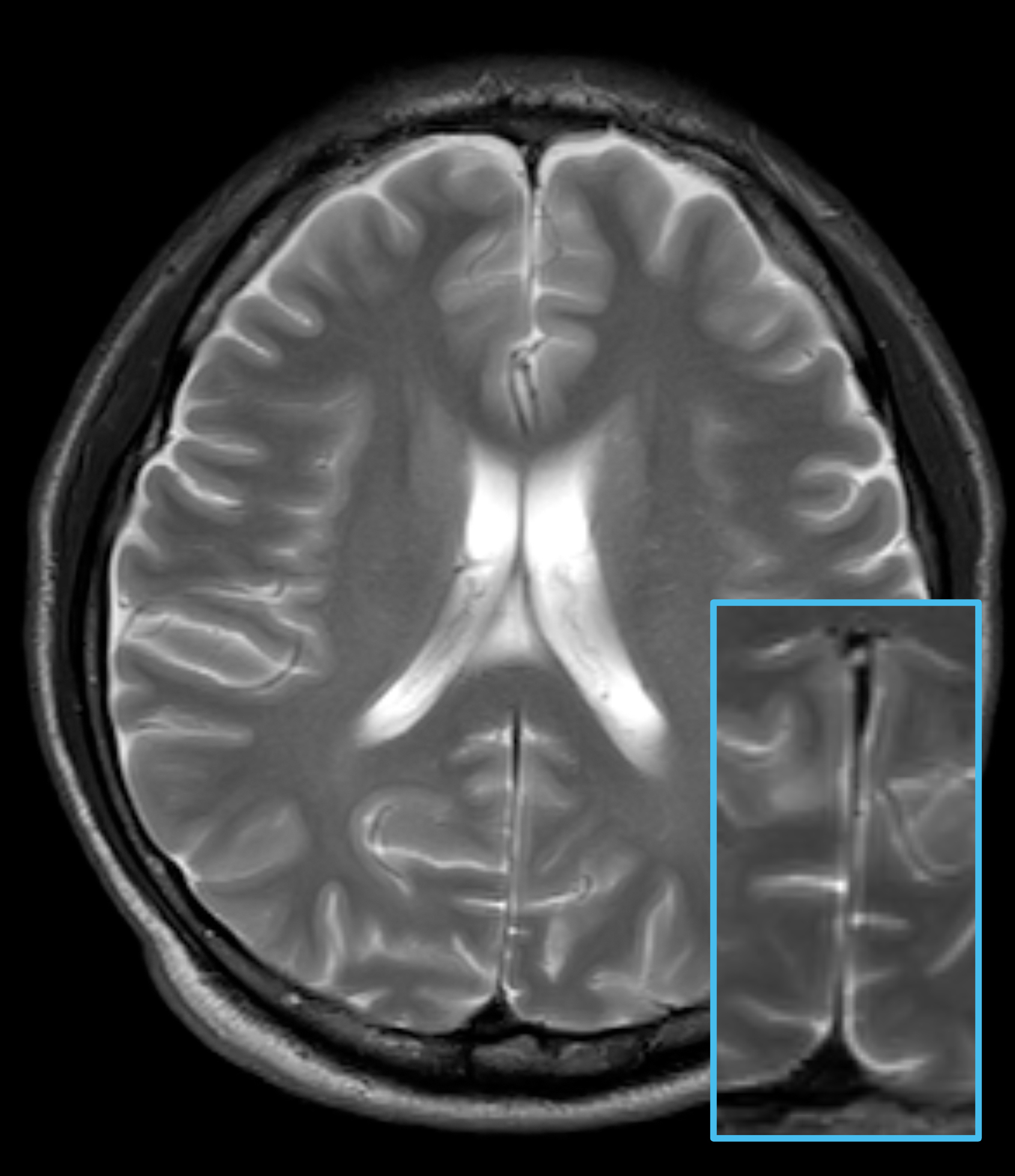 Left Image