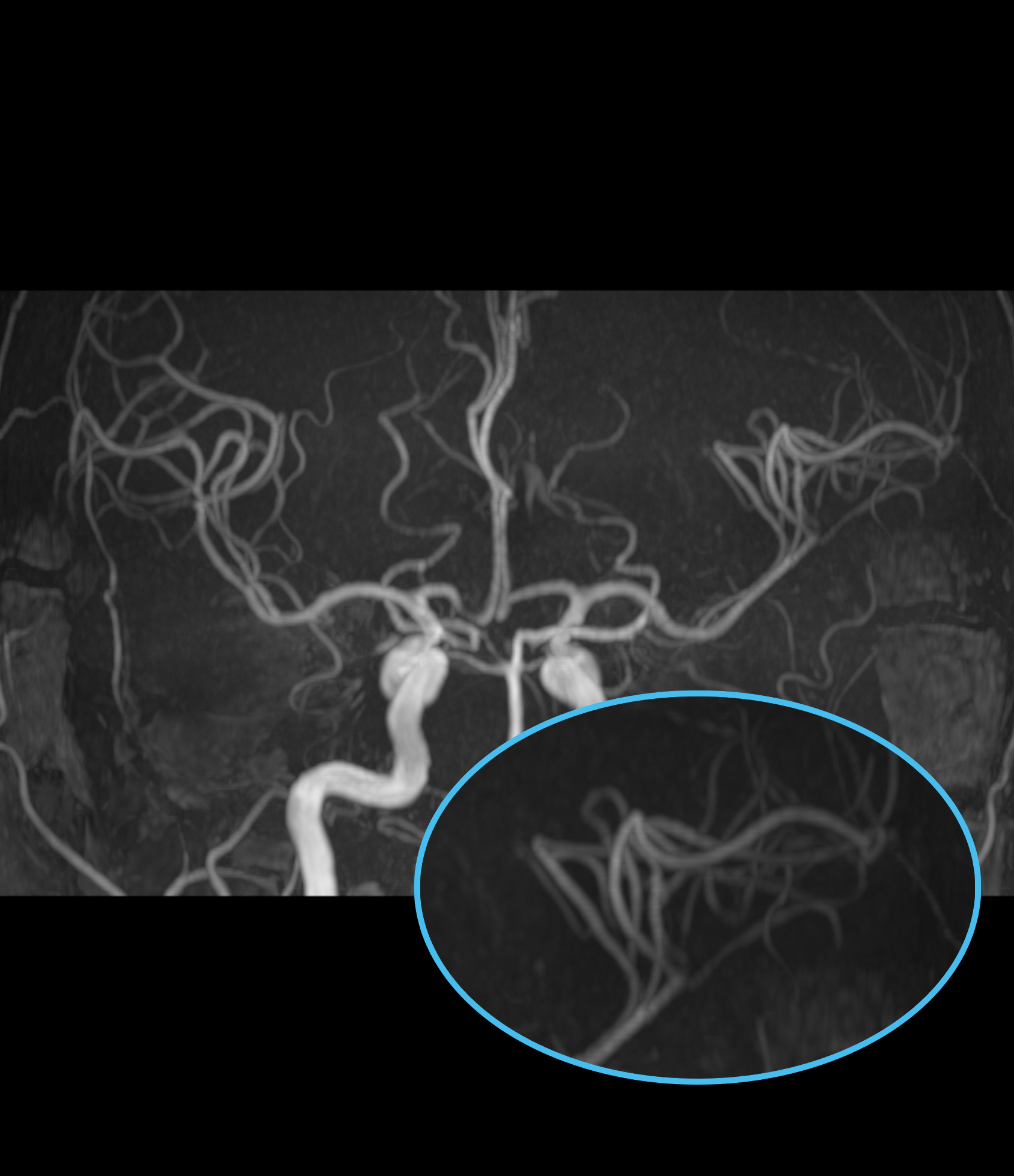 Left Image
