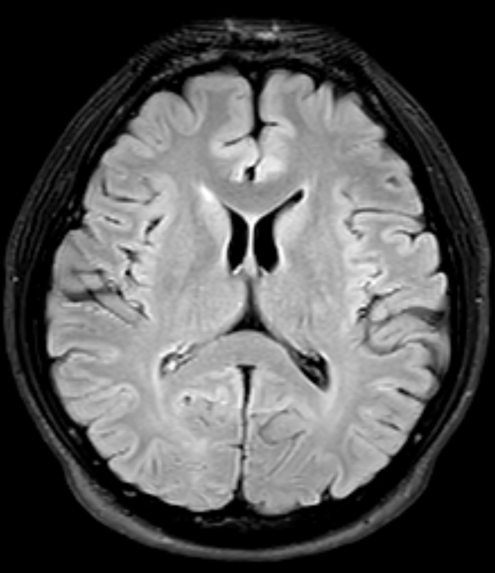 Left Image