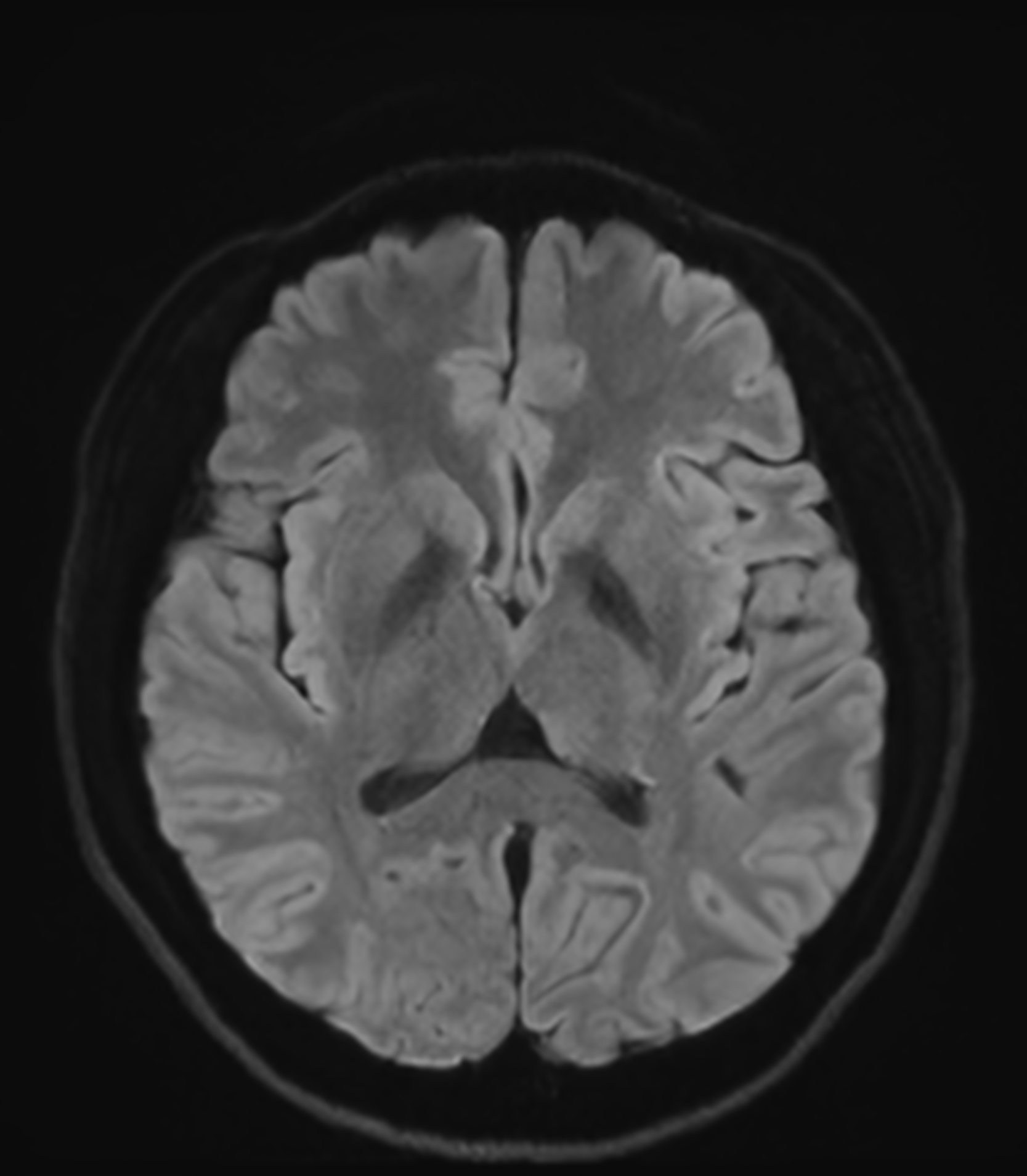 Right Image