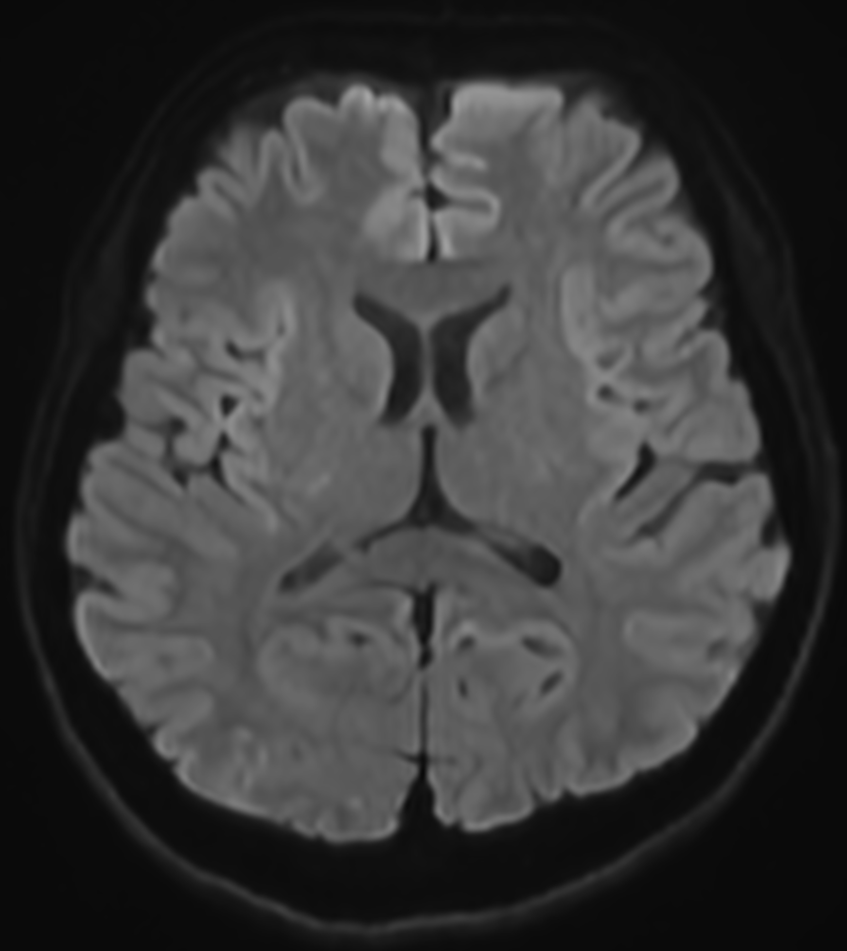 Right Image
