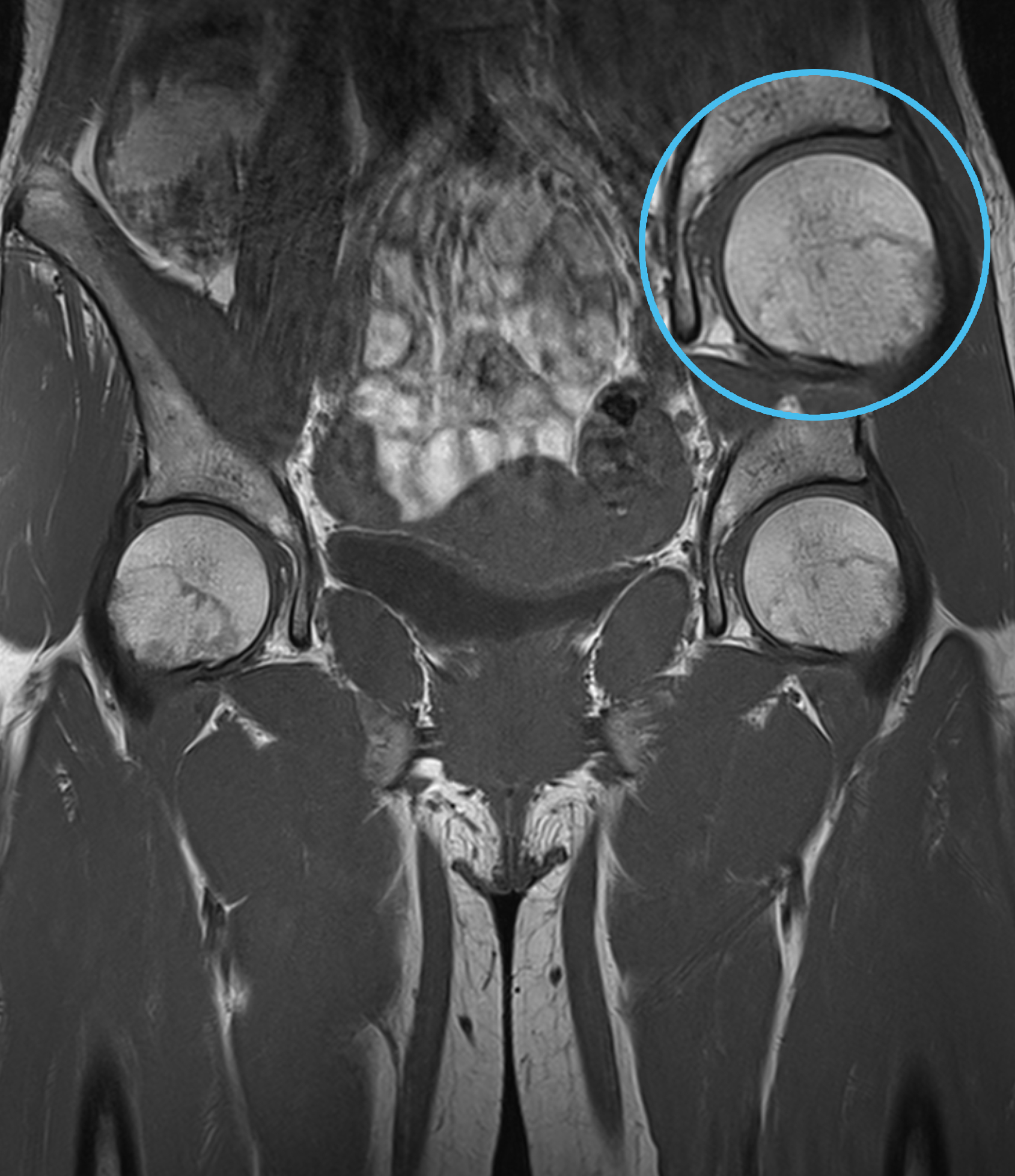 Right Image
