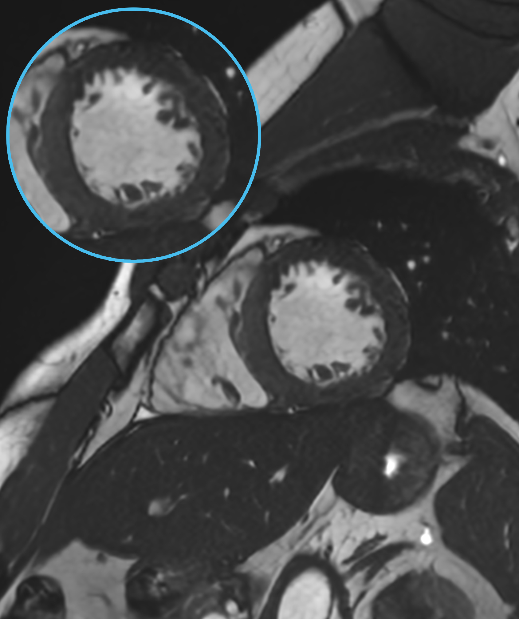 Right Image