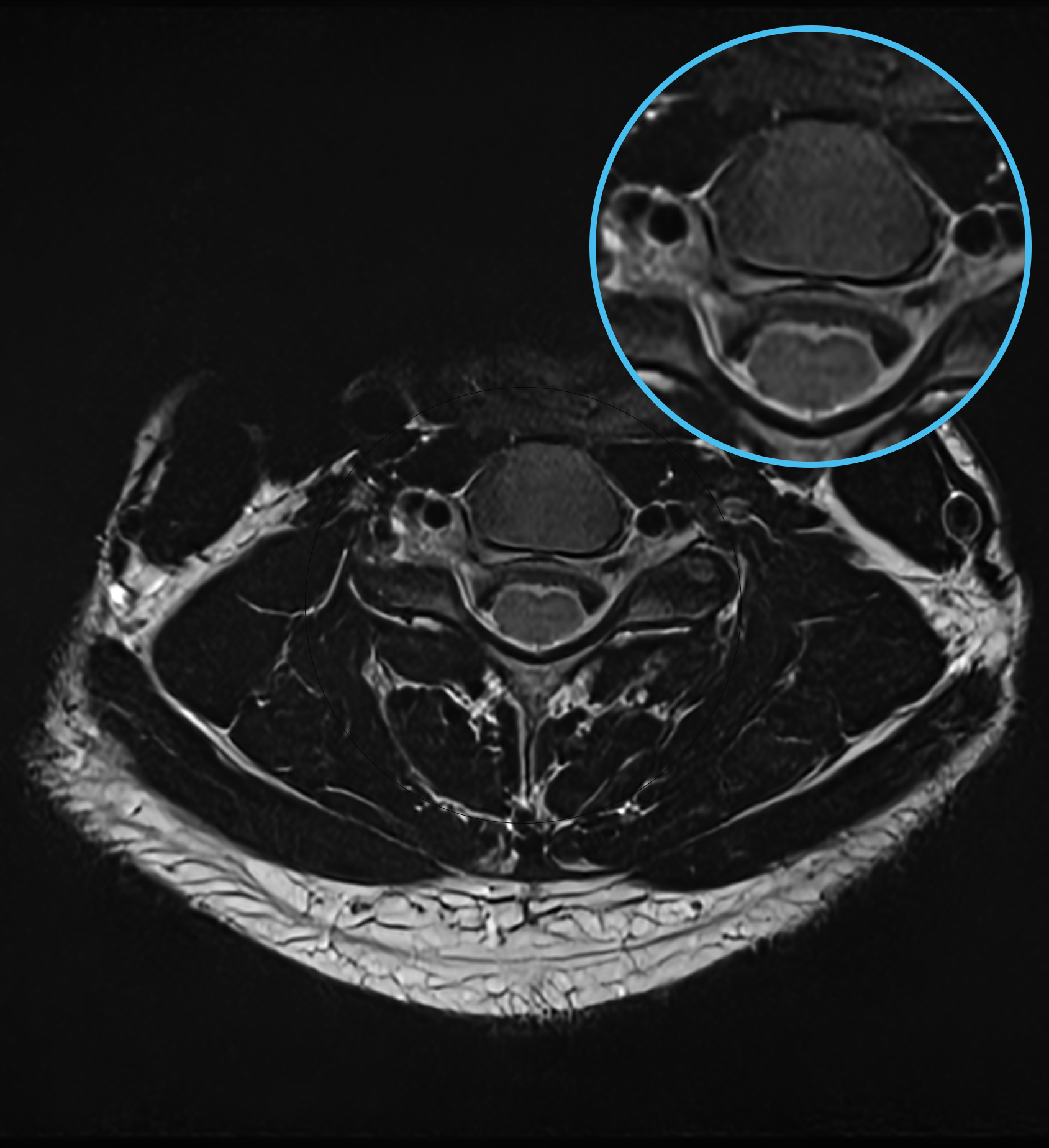 Right Image