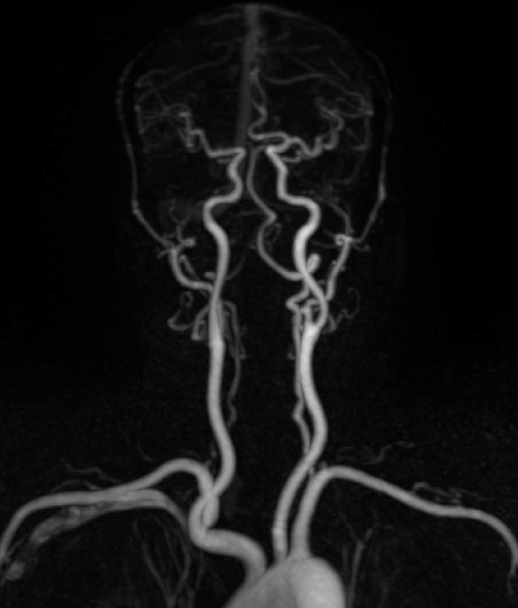 Left Image