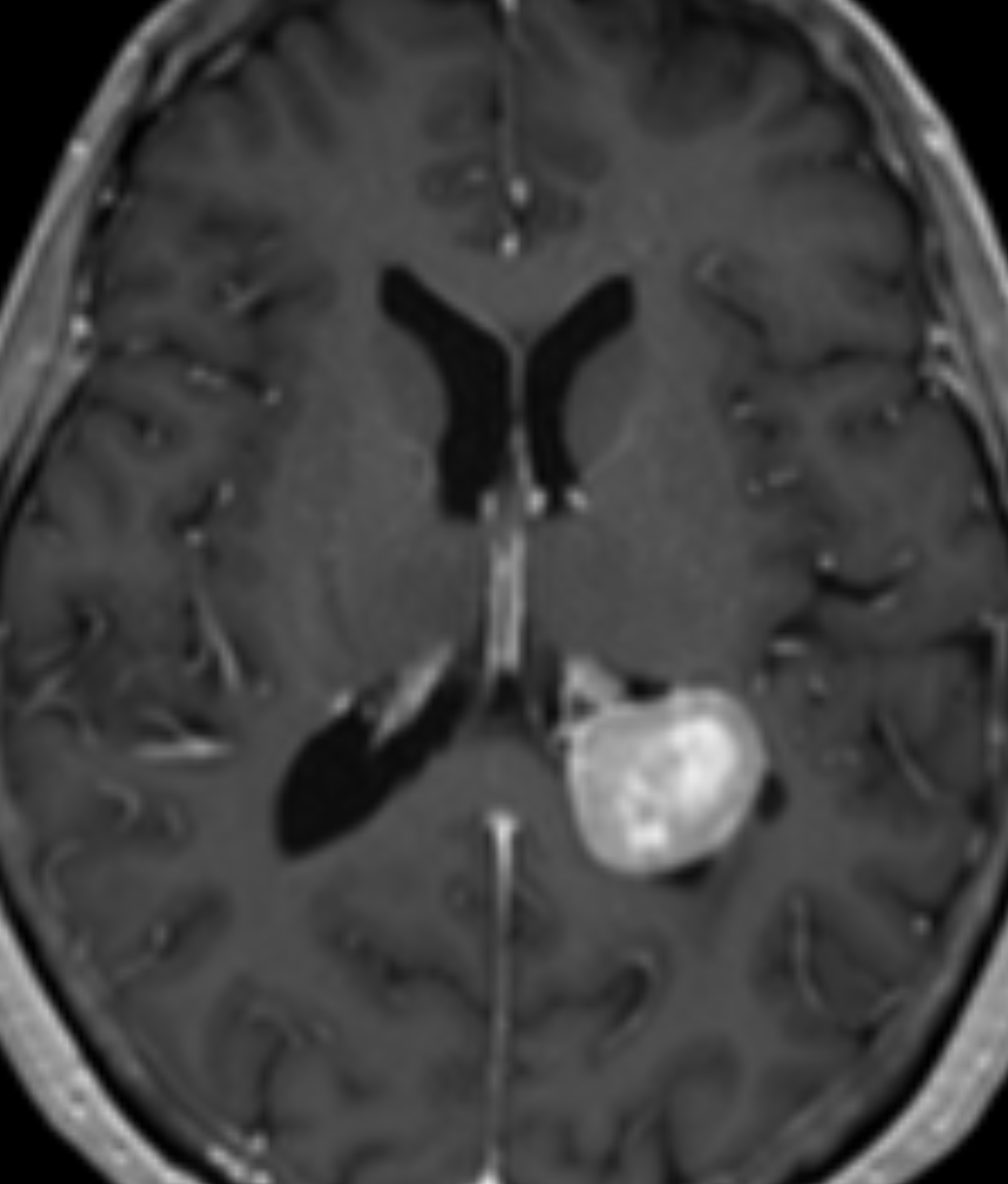 Left Image