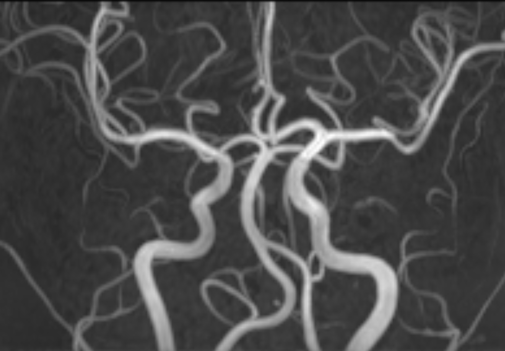 Left Image