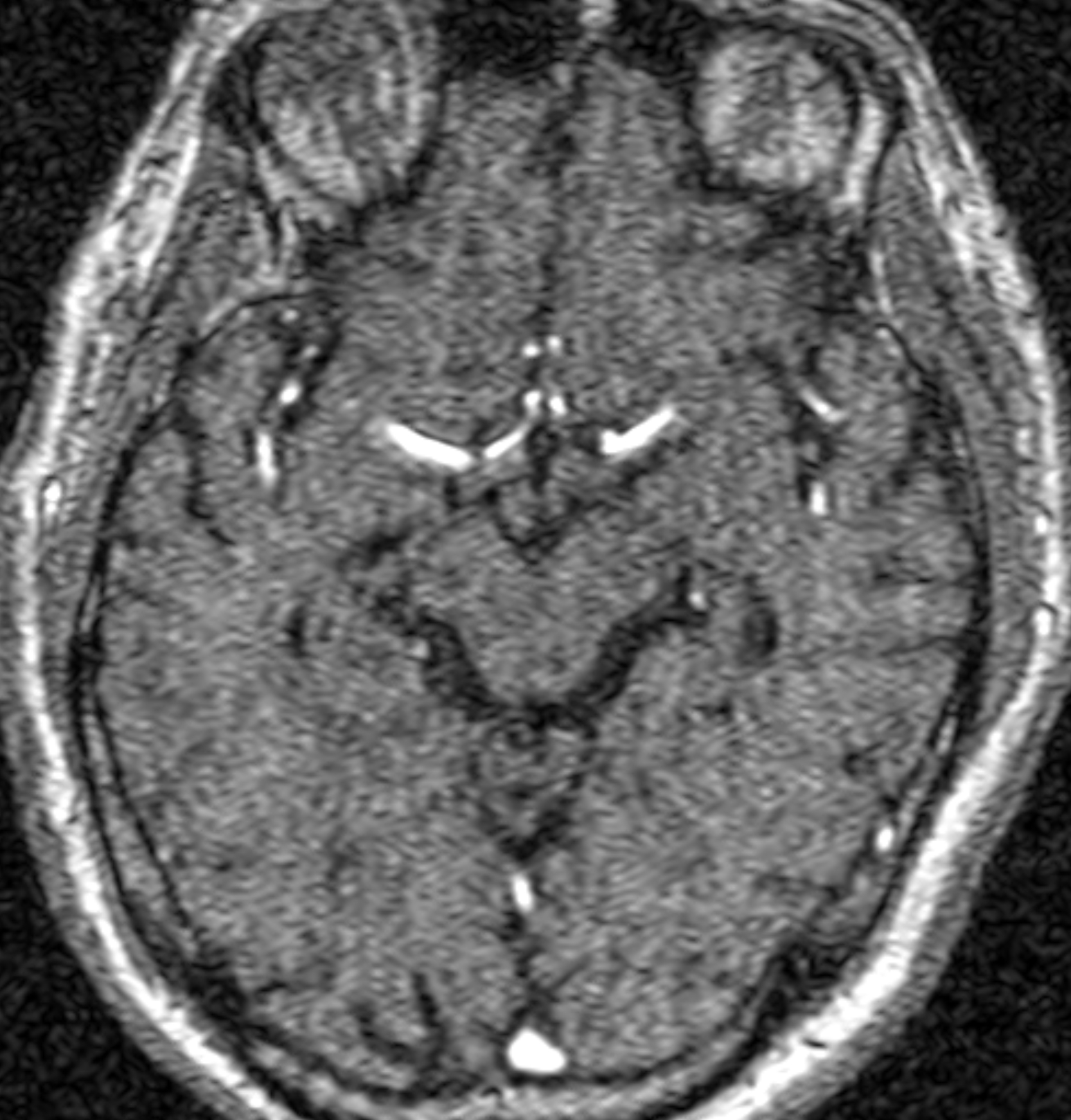 Left Image