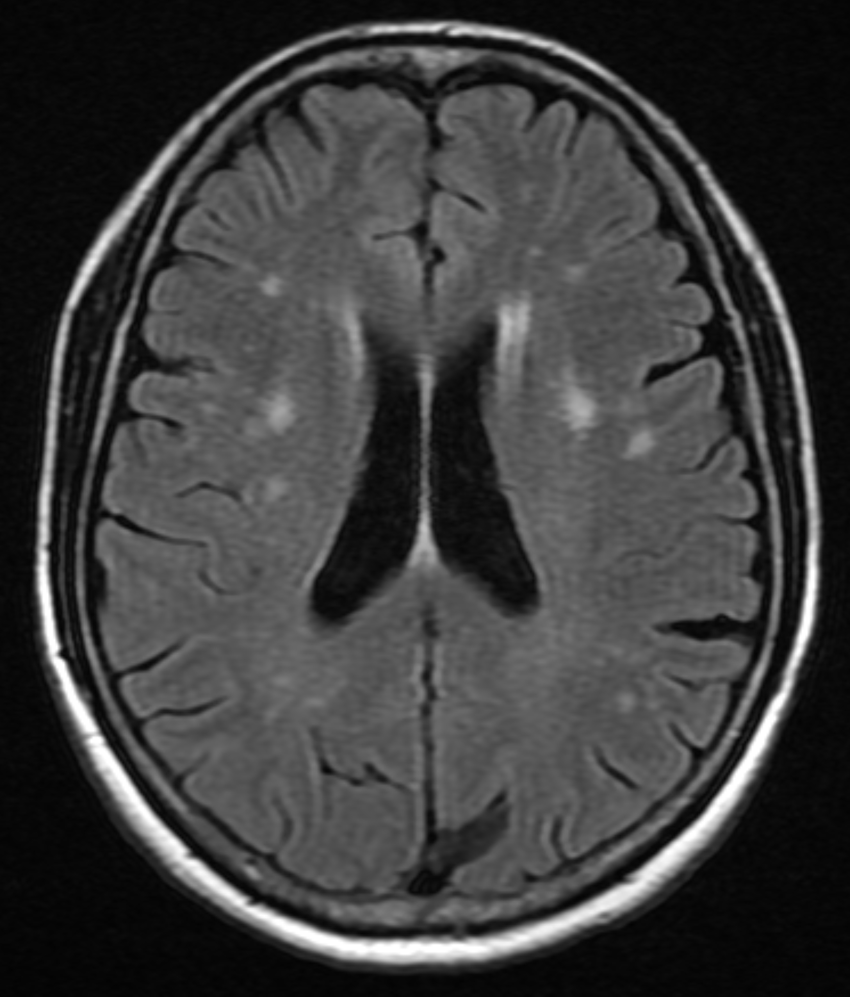 Left Image