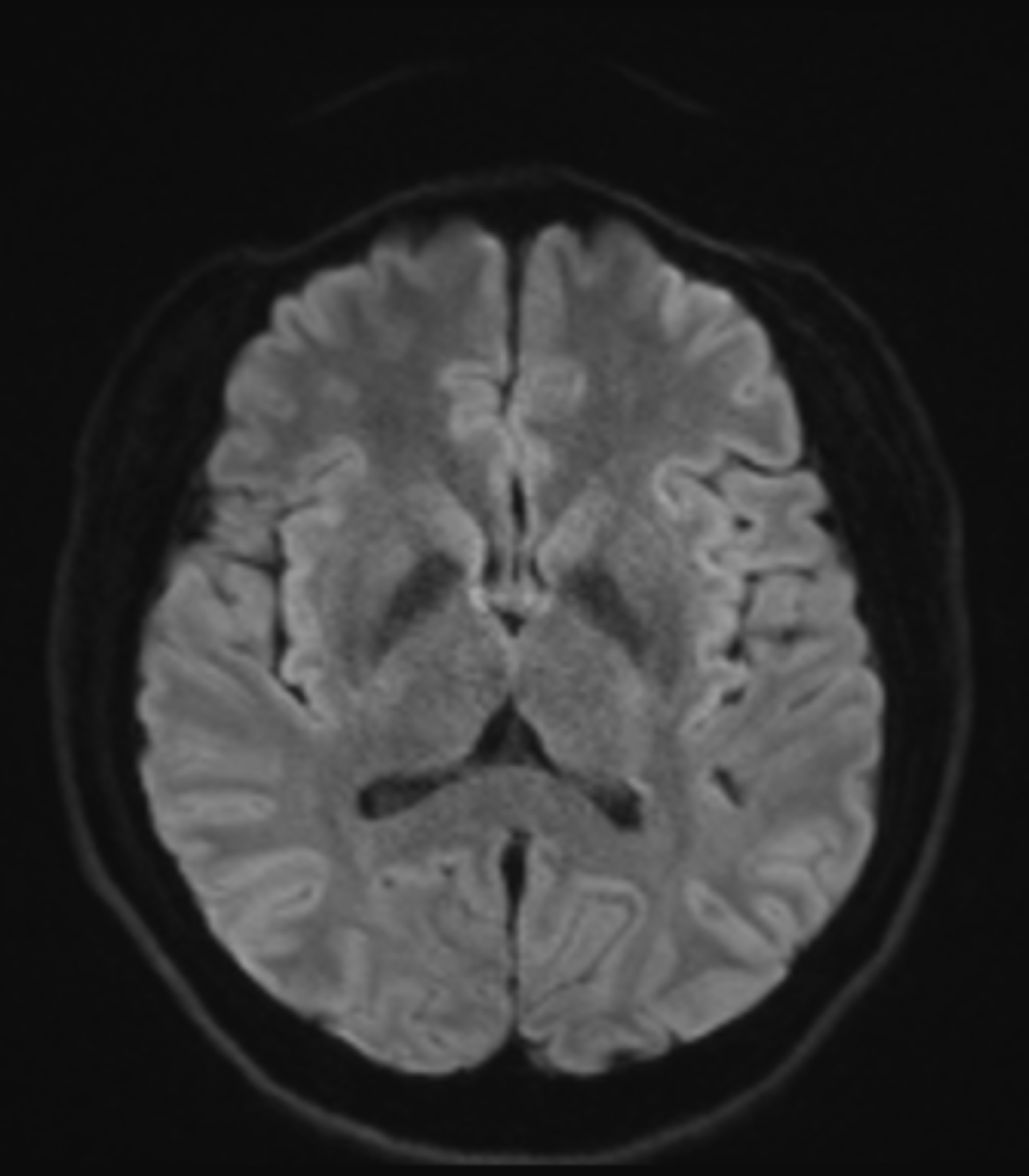Left Image