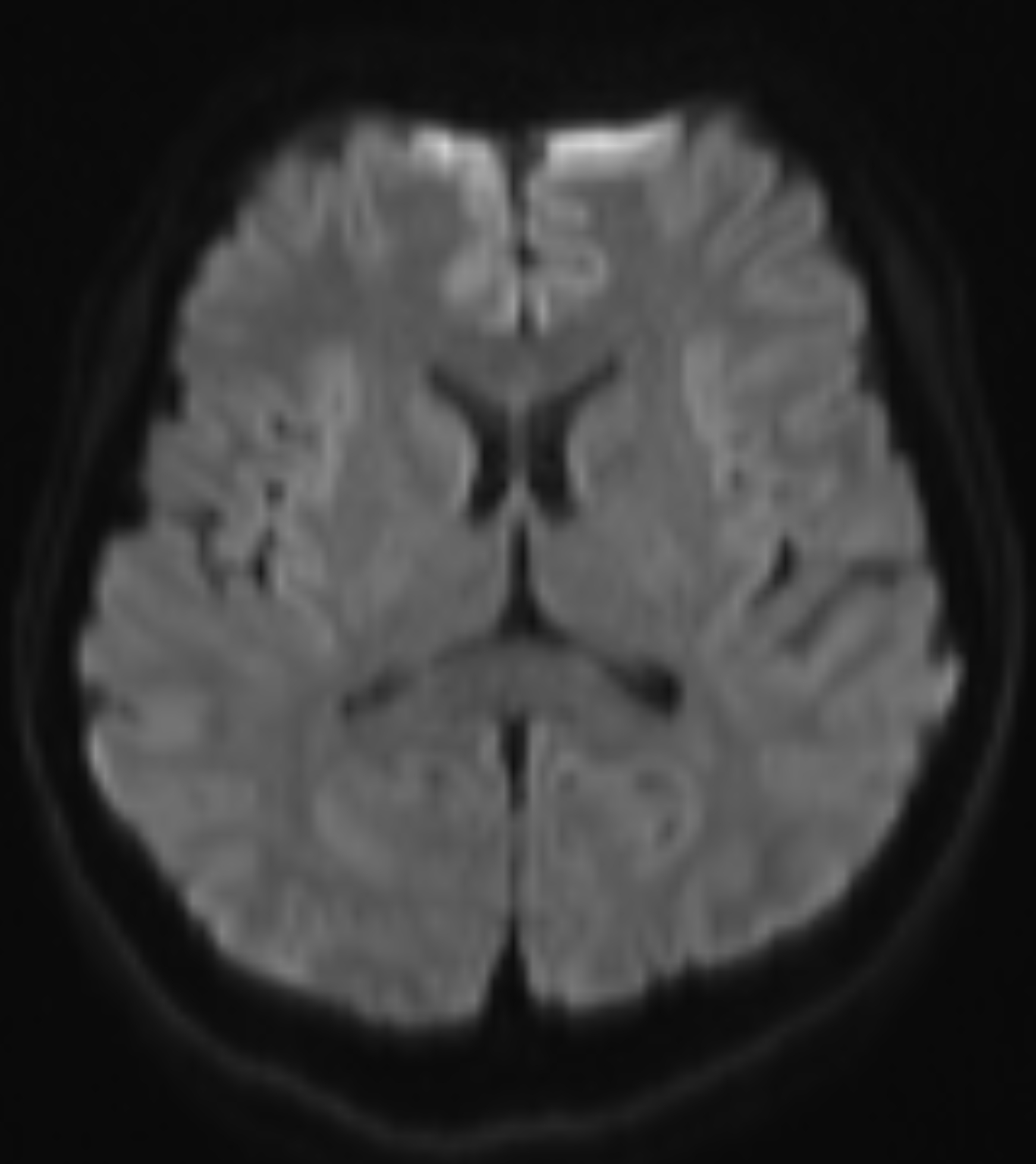 Left Image