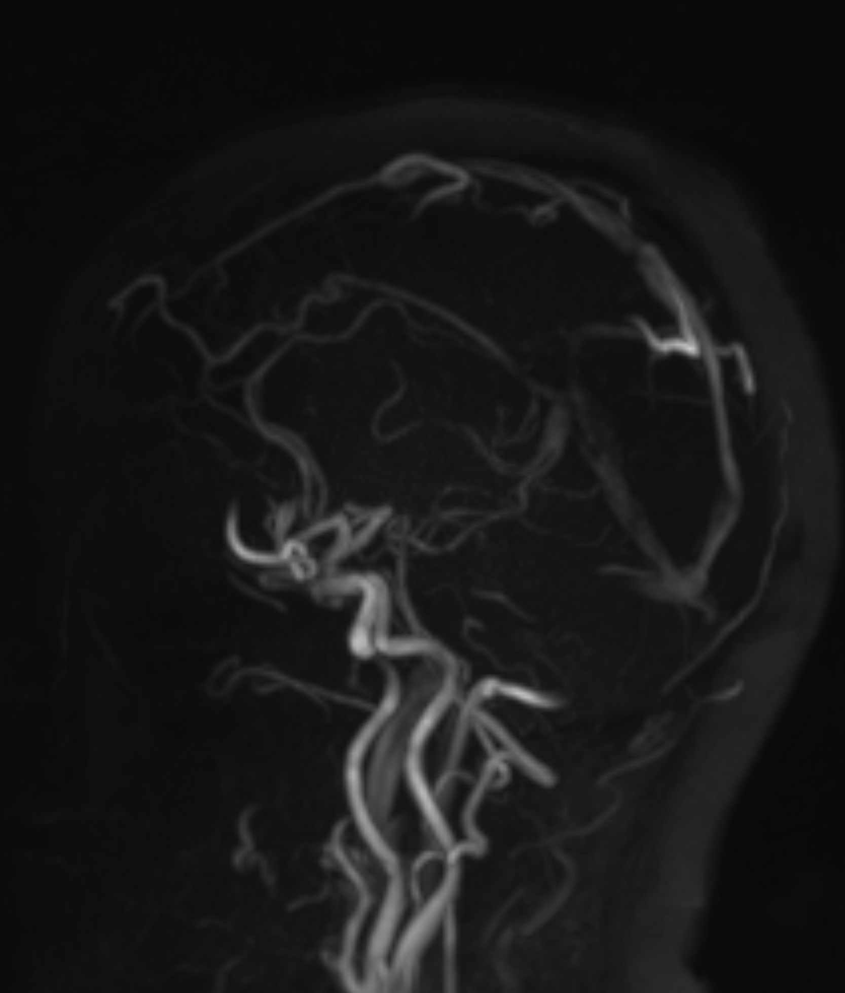 Left Image
