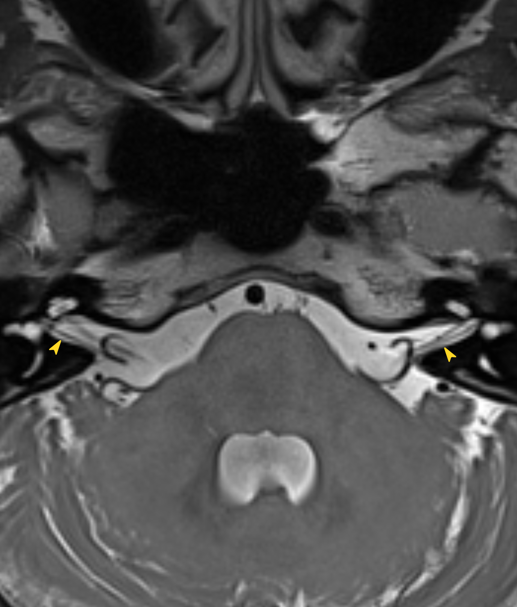Left Image