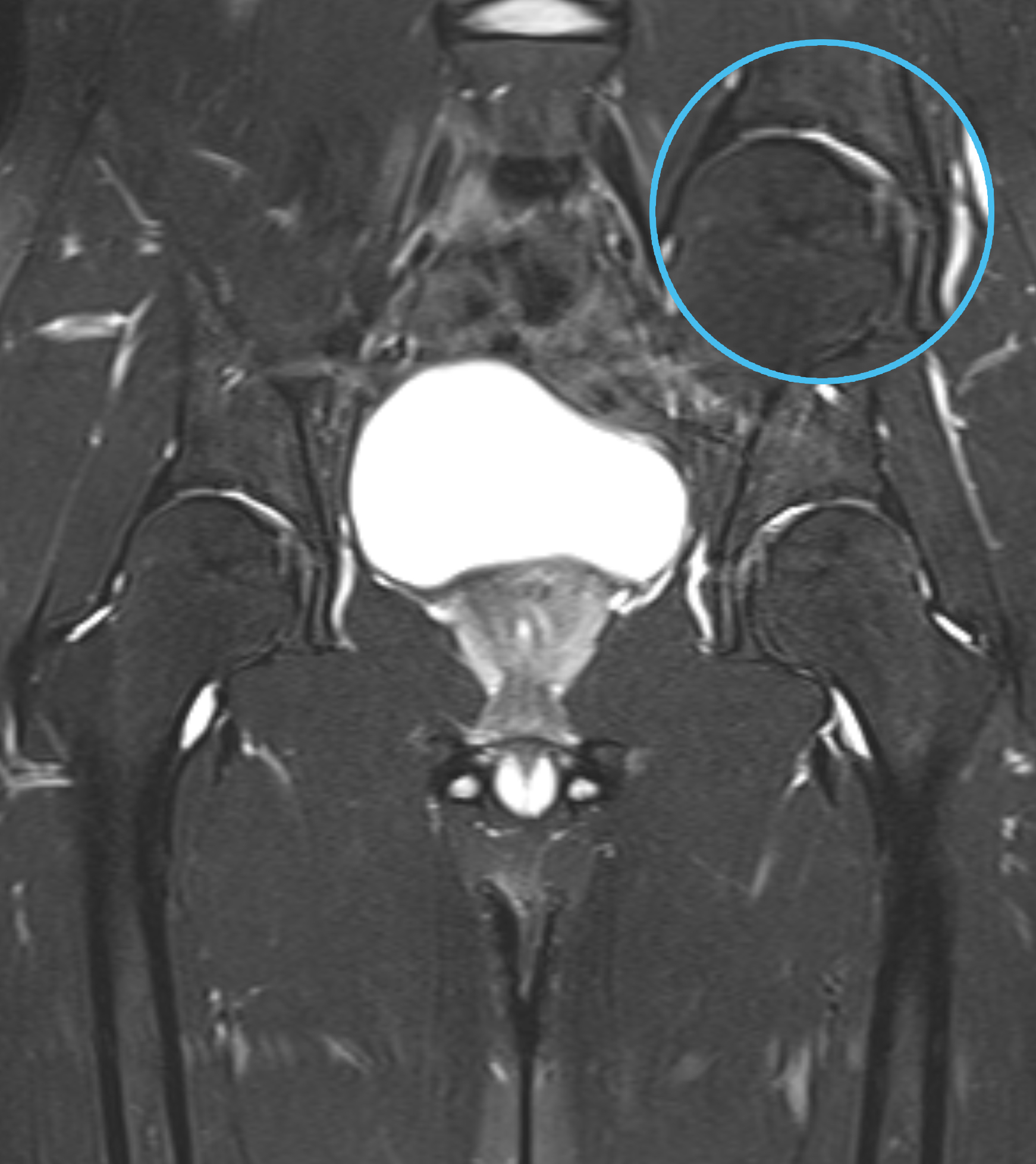 Left Image