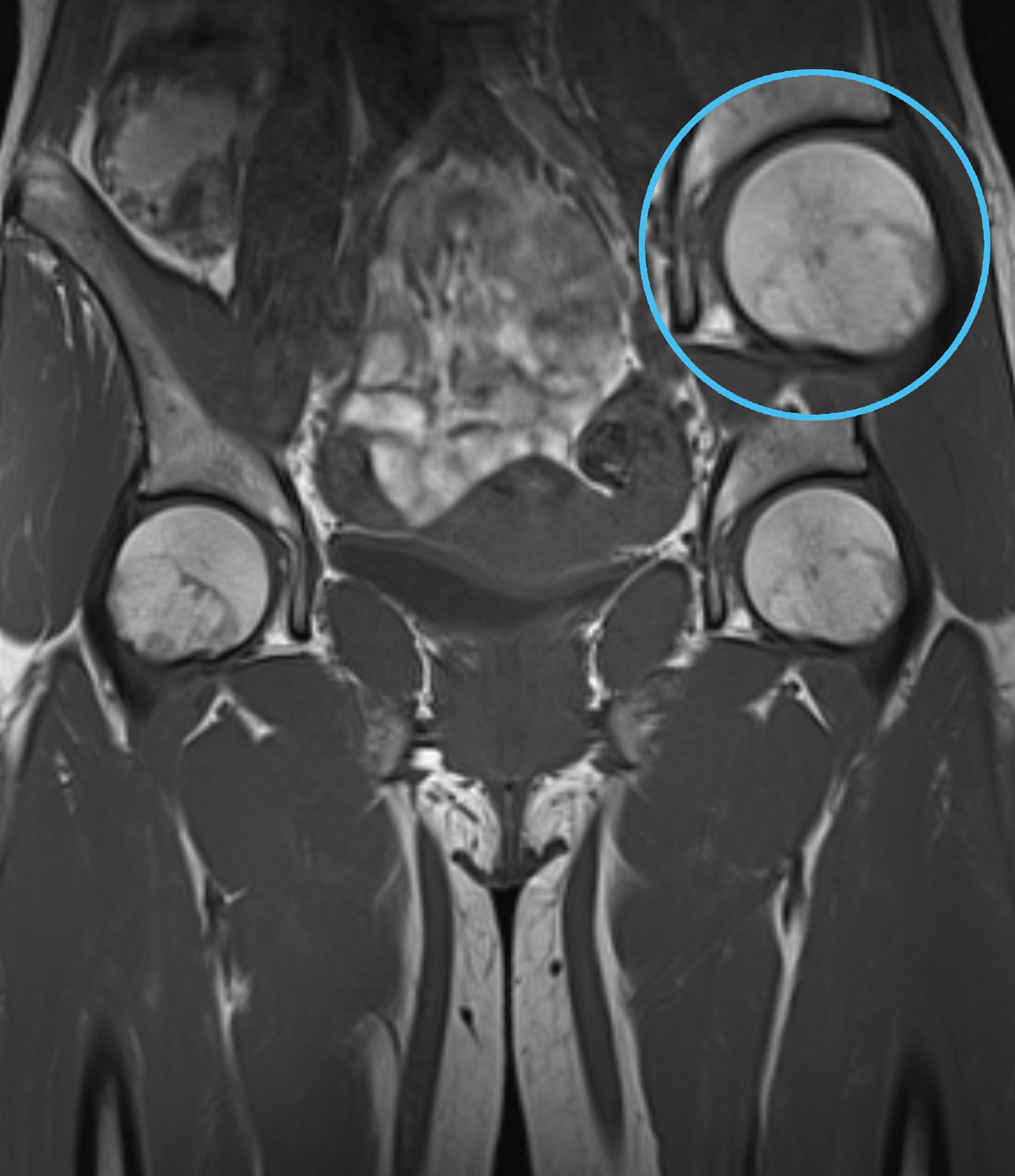 Left Image