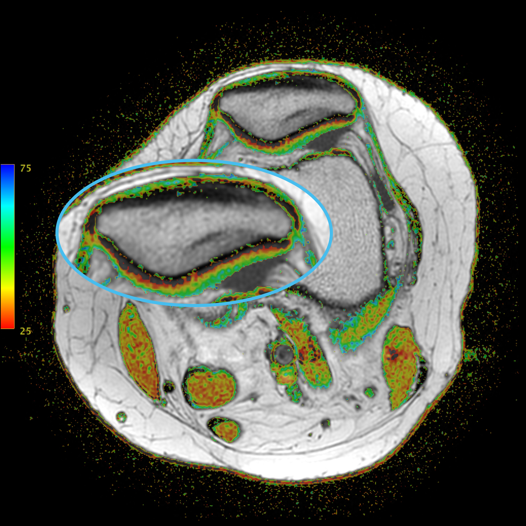 Left Image