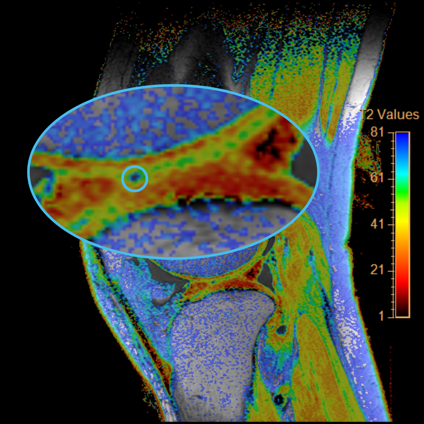 Left Image