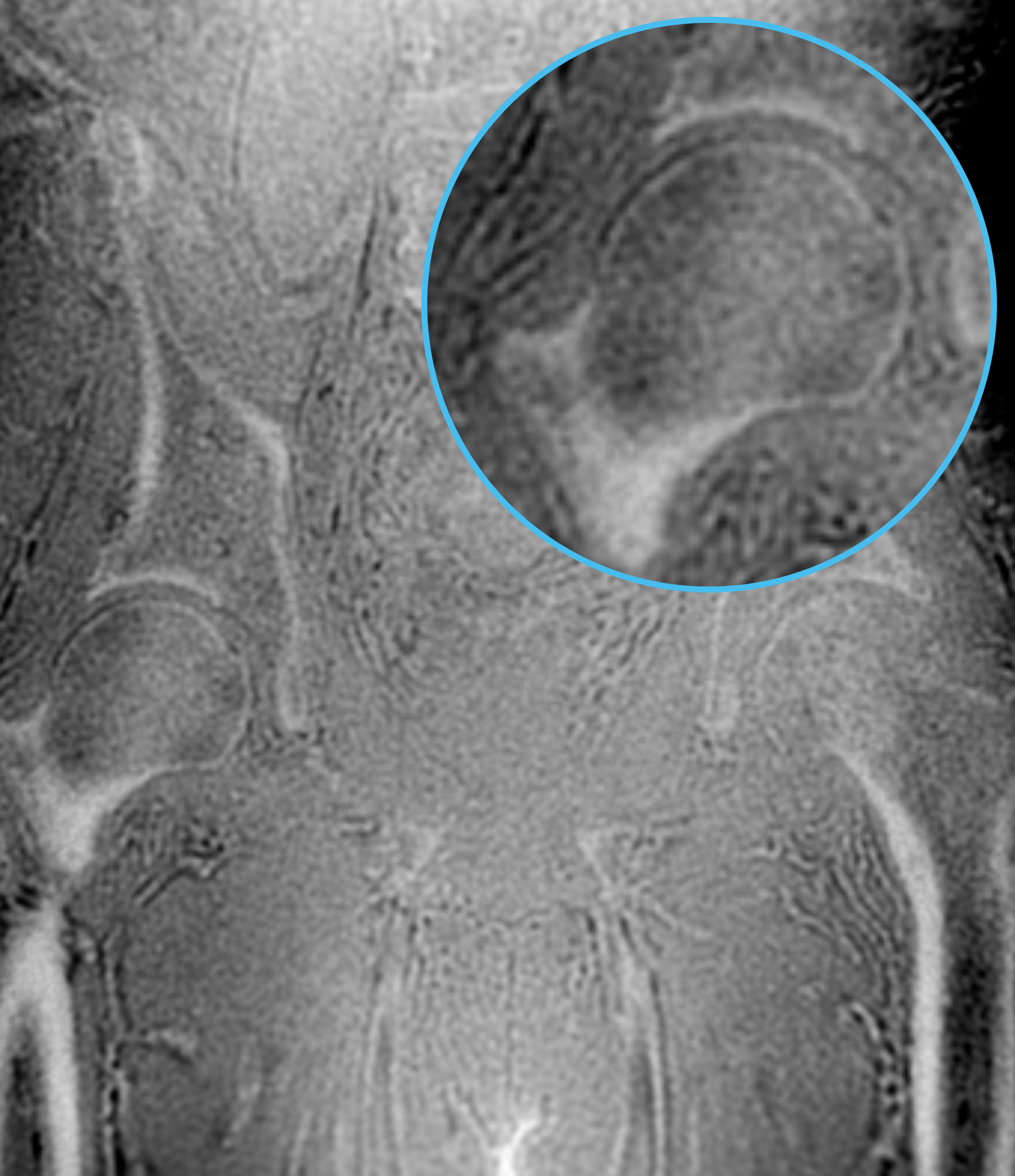 Left Image