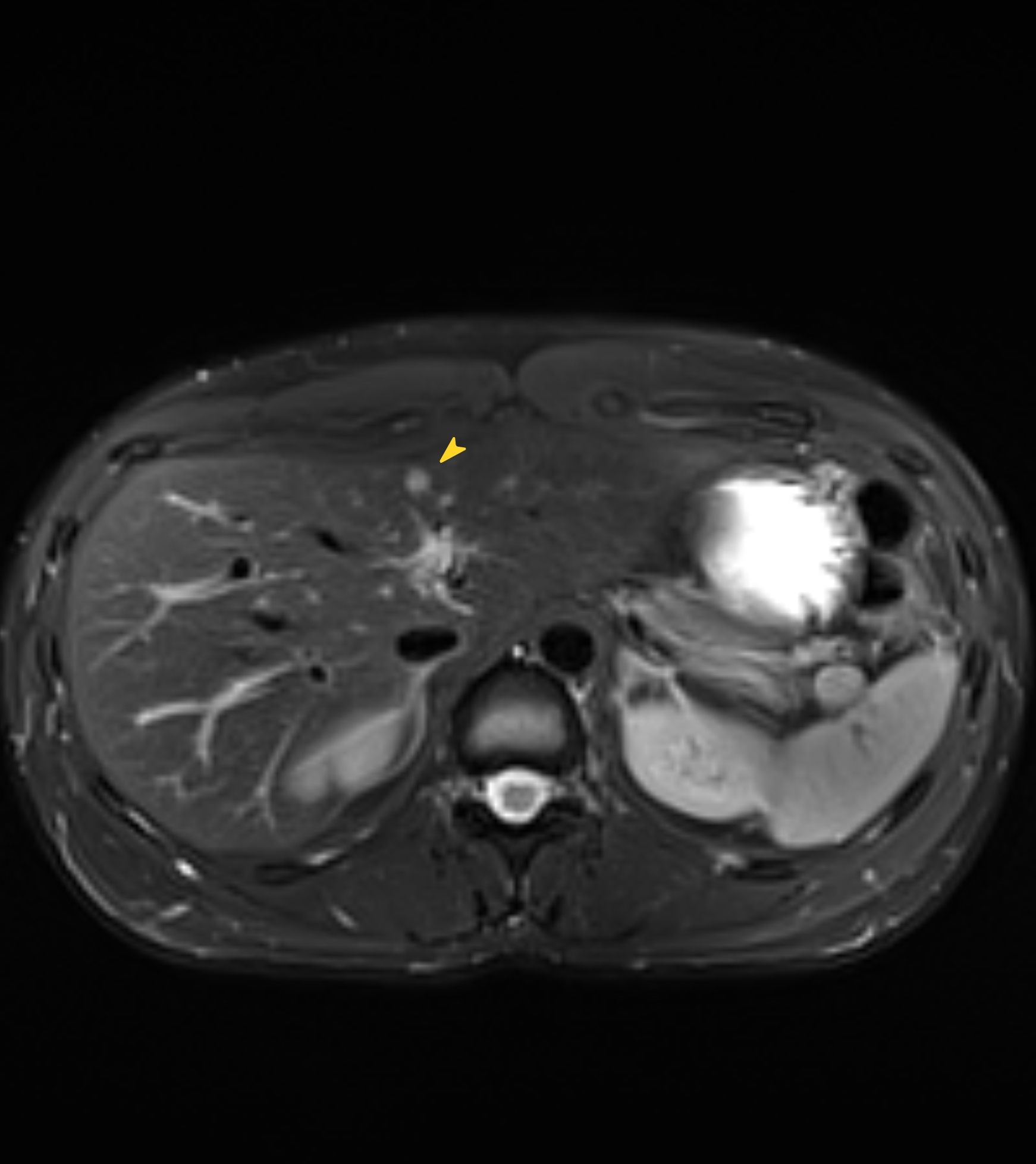 Left Image
